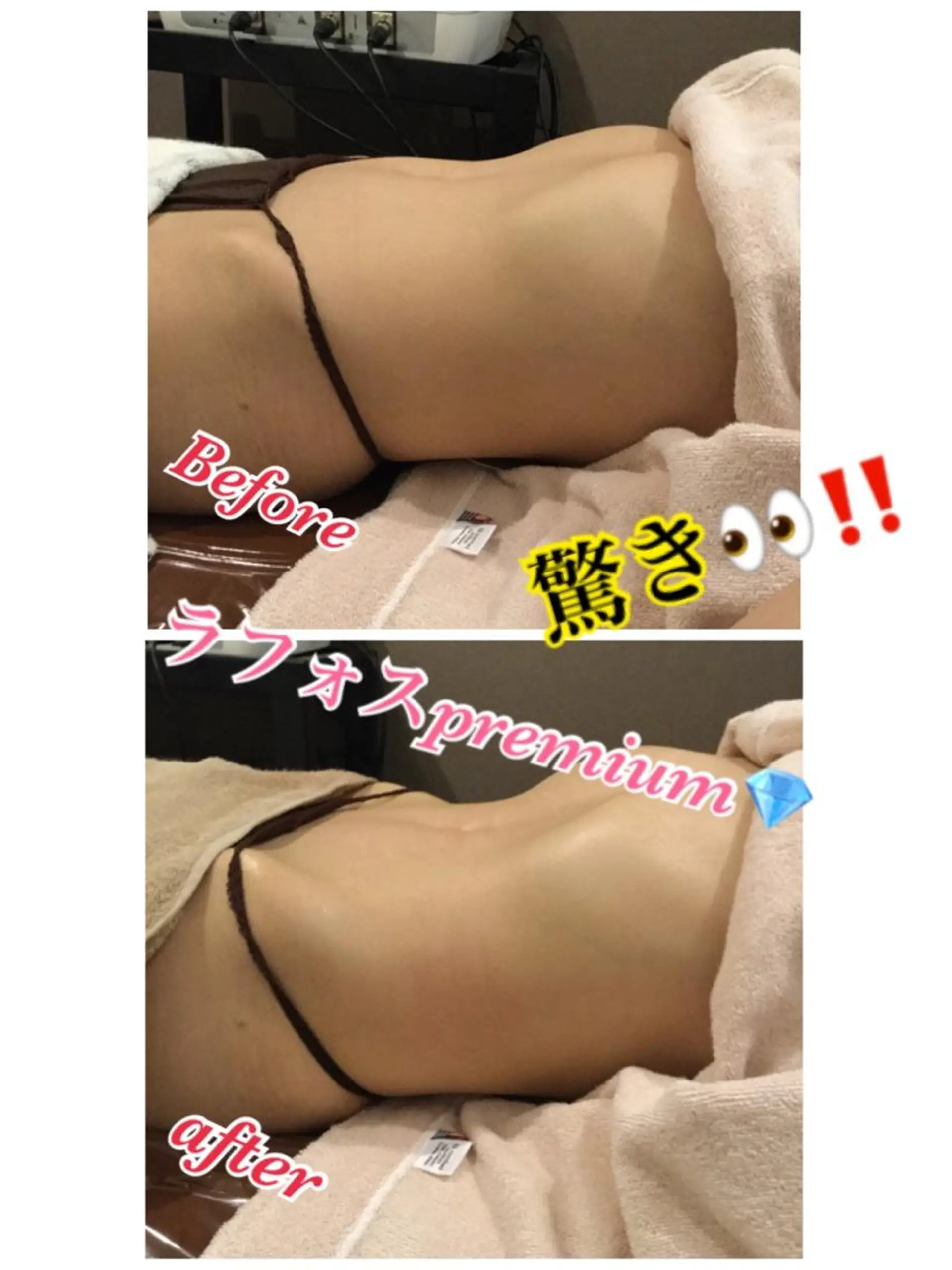 エステ 【リベルハーブピーリング認定店】敏感肌・美白脱毛専門店Dione立川店所属・Dione 立川店のエステ・リラクイメージ