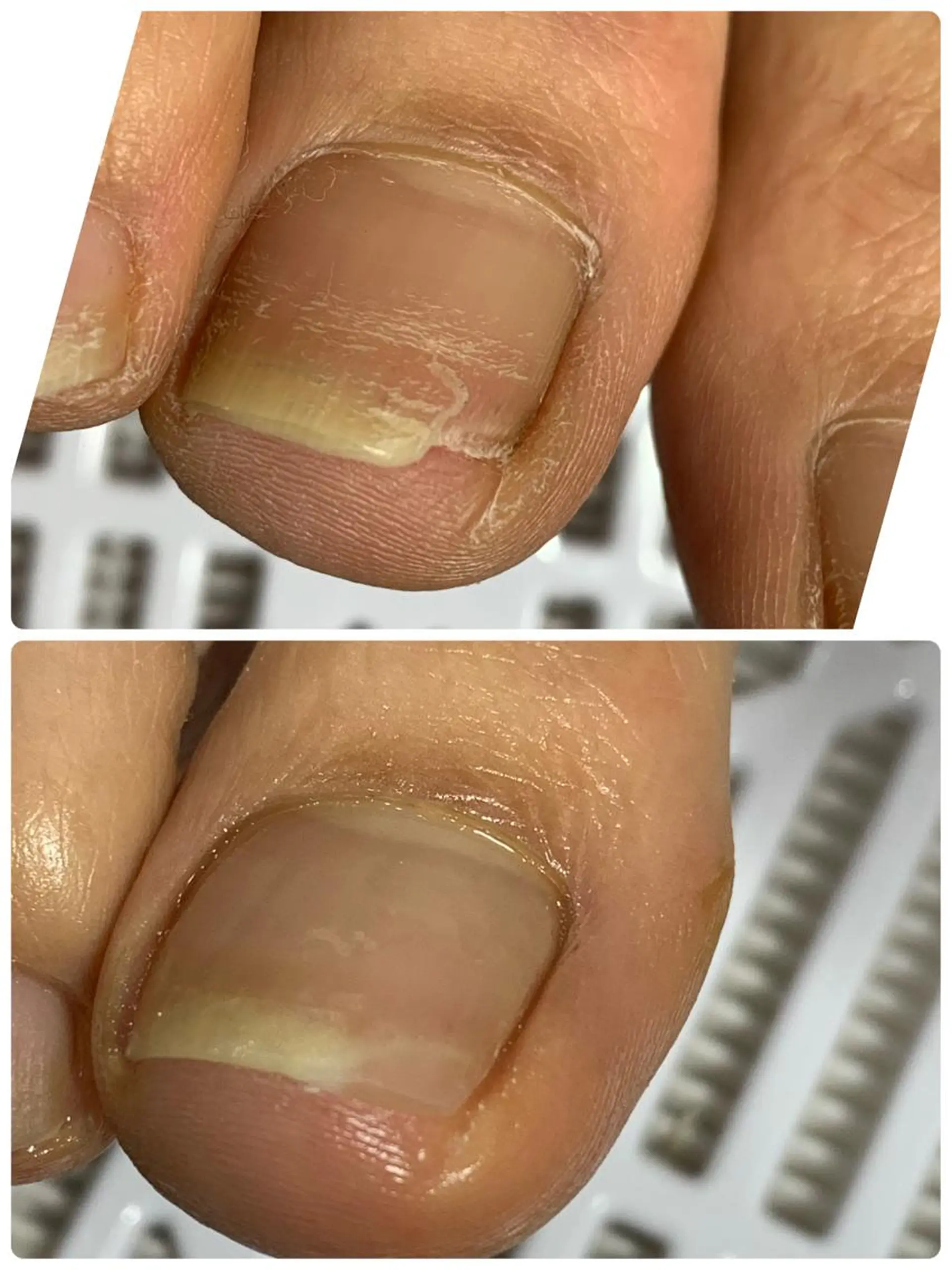 ネイル フットネイル メンズトータルビューティーwellnessMARCA所属・【メンズ美容】 三浦かえでのネイルデザイン