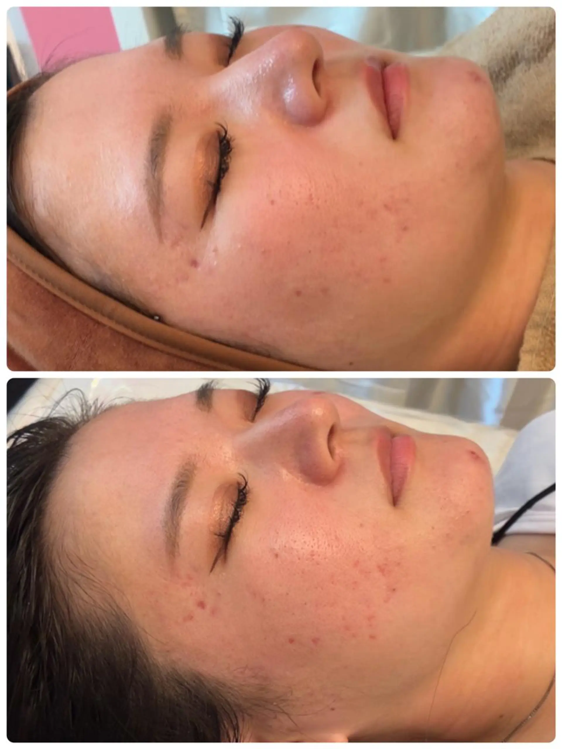 FLEUR🫧 フェイシャルのエステ・リラクイメージ