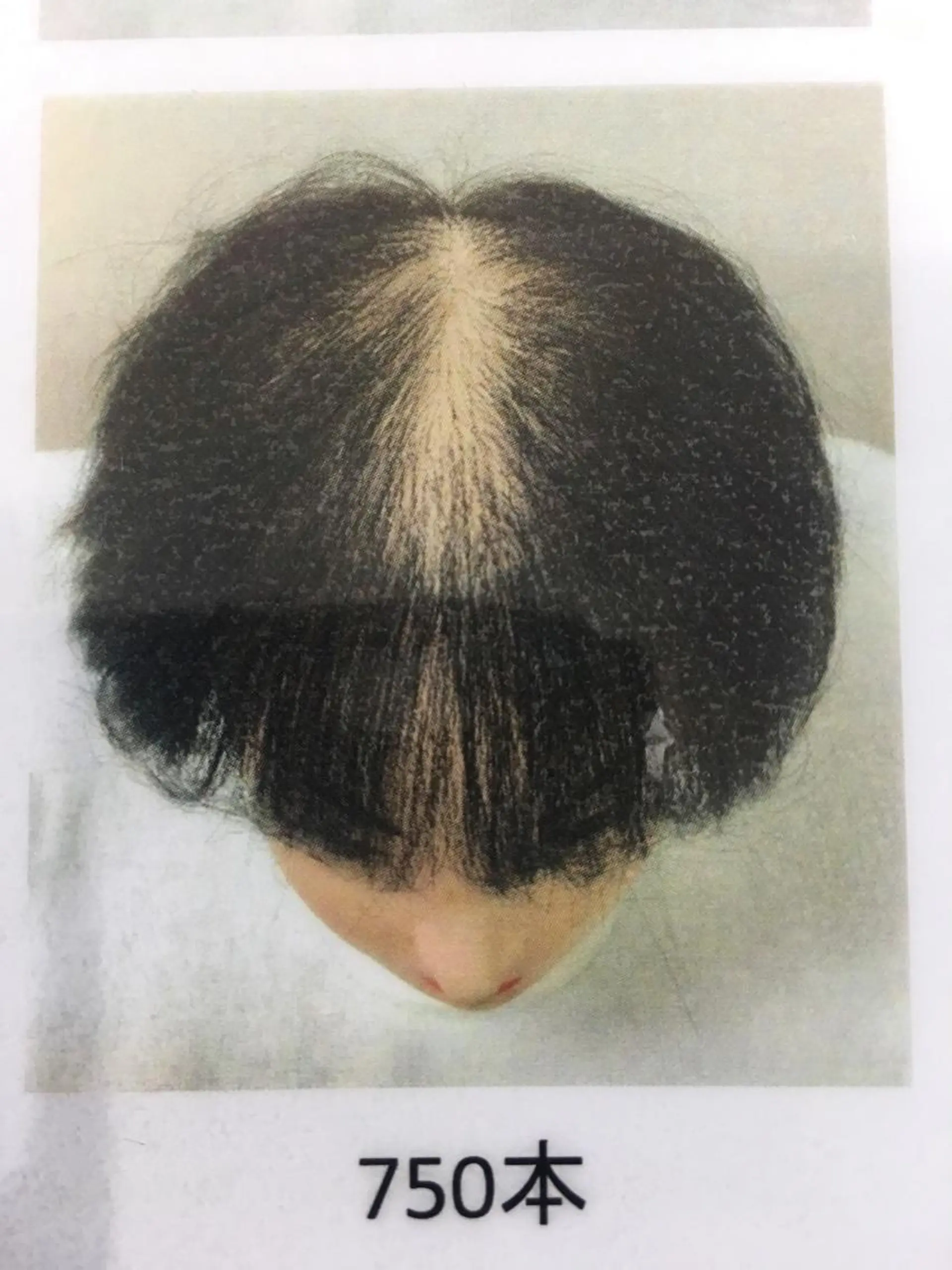 ショート メンズ エクステ select+所属・kanamoto yuriのその他イメージ