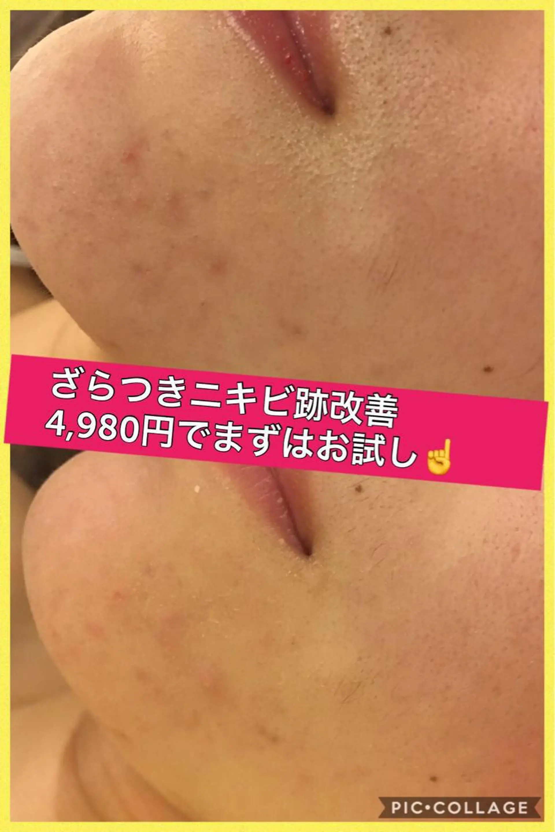 ショート カラー パーマ ヘアアレンジ メンズ キッズ ネイル マツエク・マツパ ニキビ・肌質改善専門 ♡人生が変わるサロンのエステ・リラクイメージ