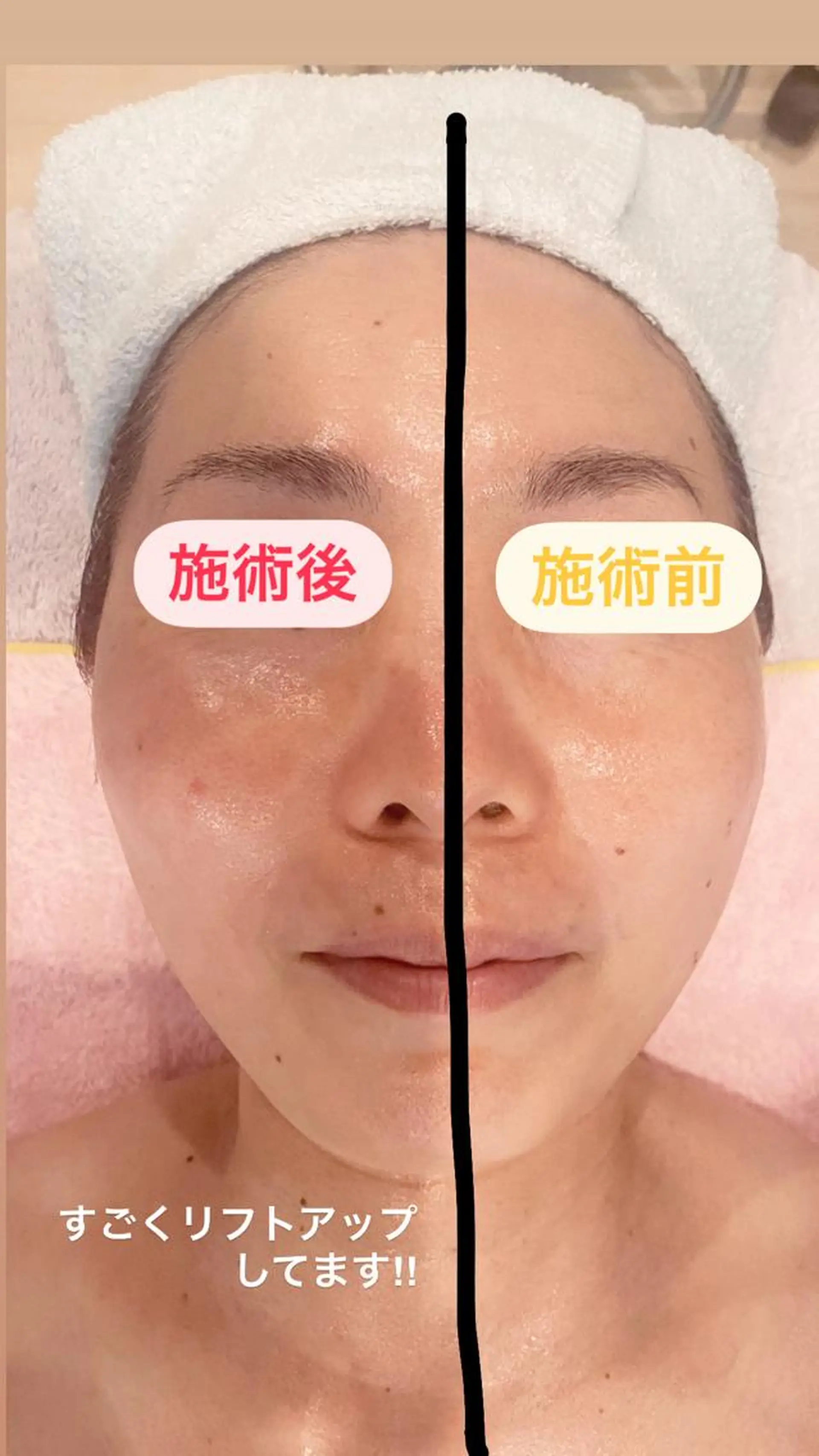 ショート マツエク・マツパ アイブロウ 小倉 麻由のエステ・リラクイメージ