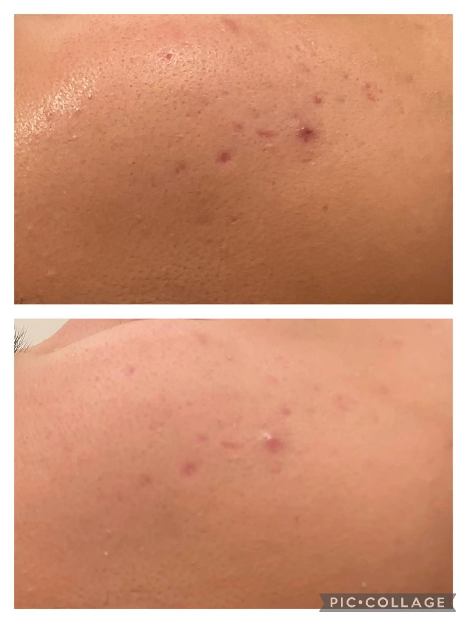 セミロング カラー パーマ ヘアアレンジ キッズ ネイル マツエク・マツパ アイブロウ 🔥3か月で肌革命 🔥ニキビ専門店のエステ・リラクイメージ