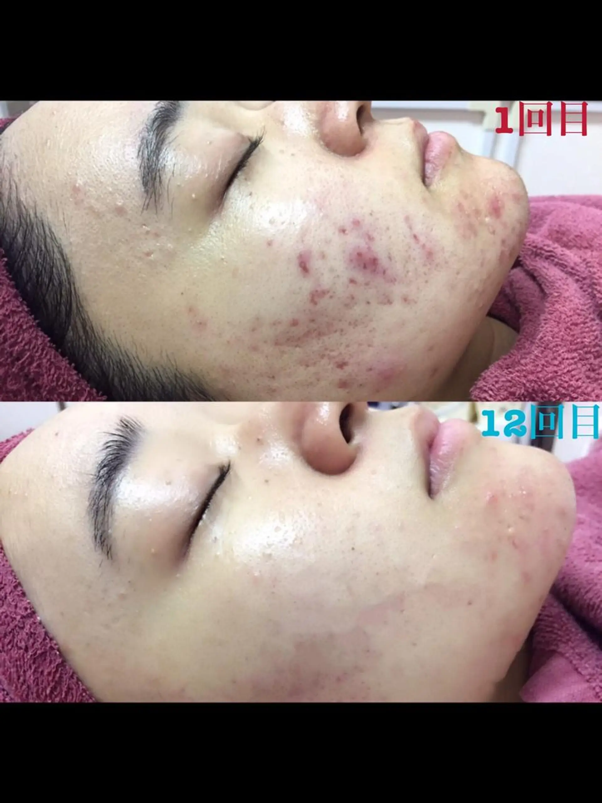 透明感の肌Lino malieのエステ・リラクイメージ