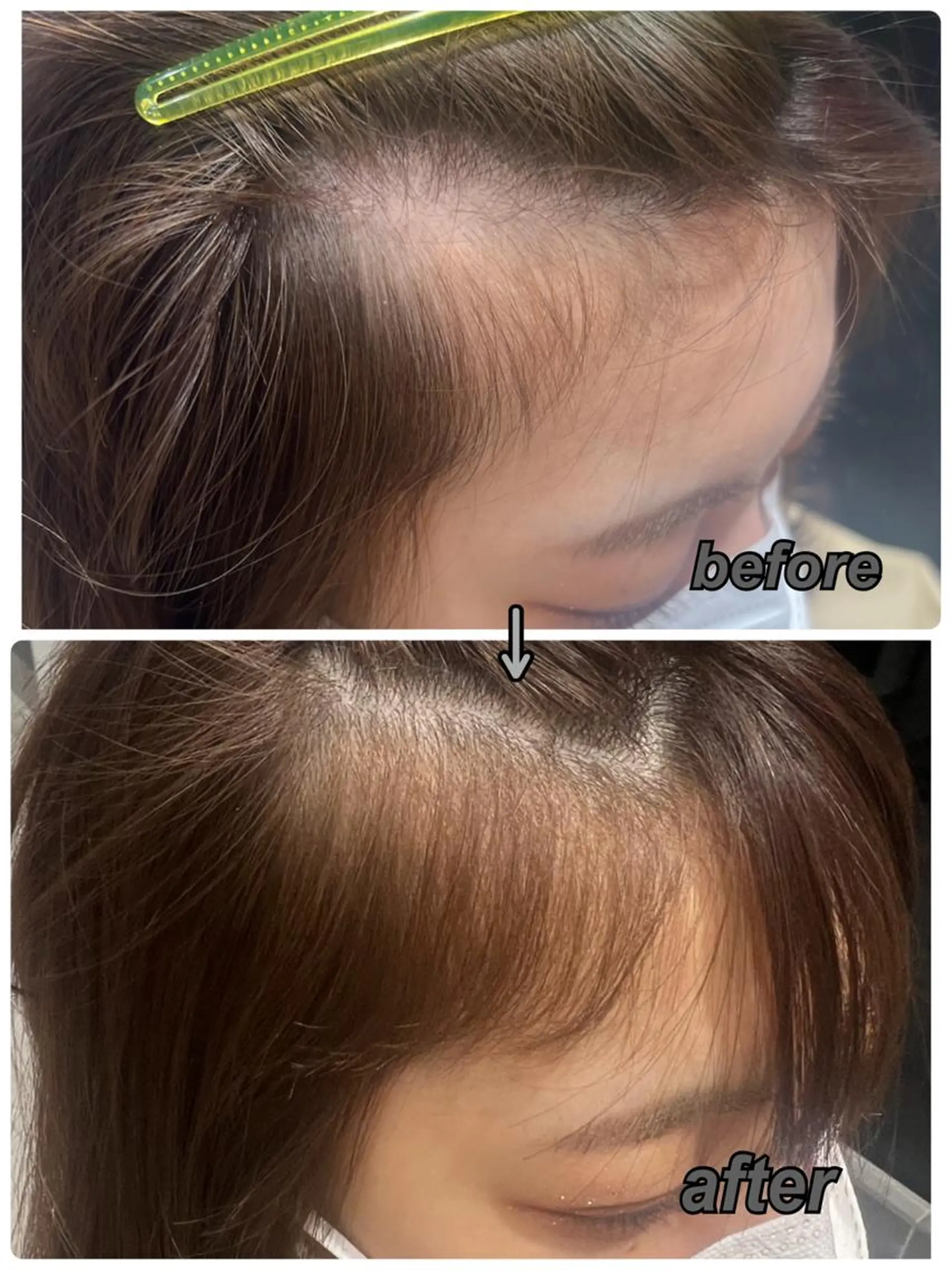 ショート パーマ 韓国hair ·͜· watanabeのヘアスタイル