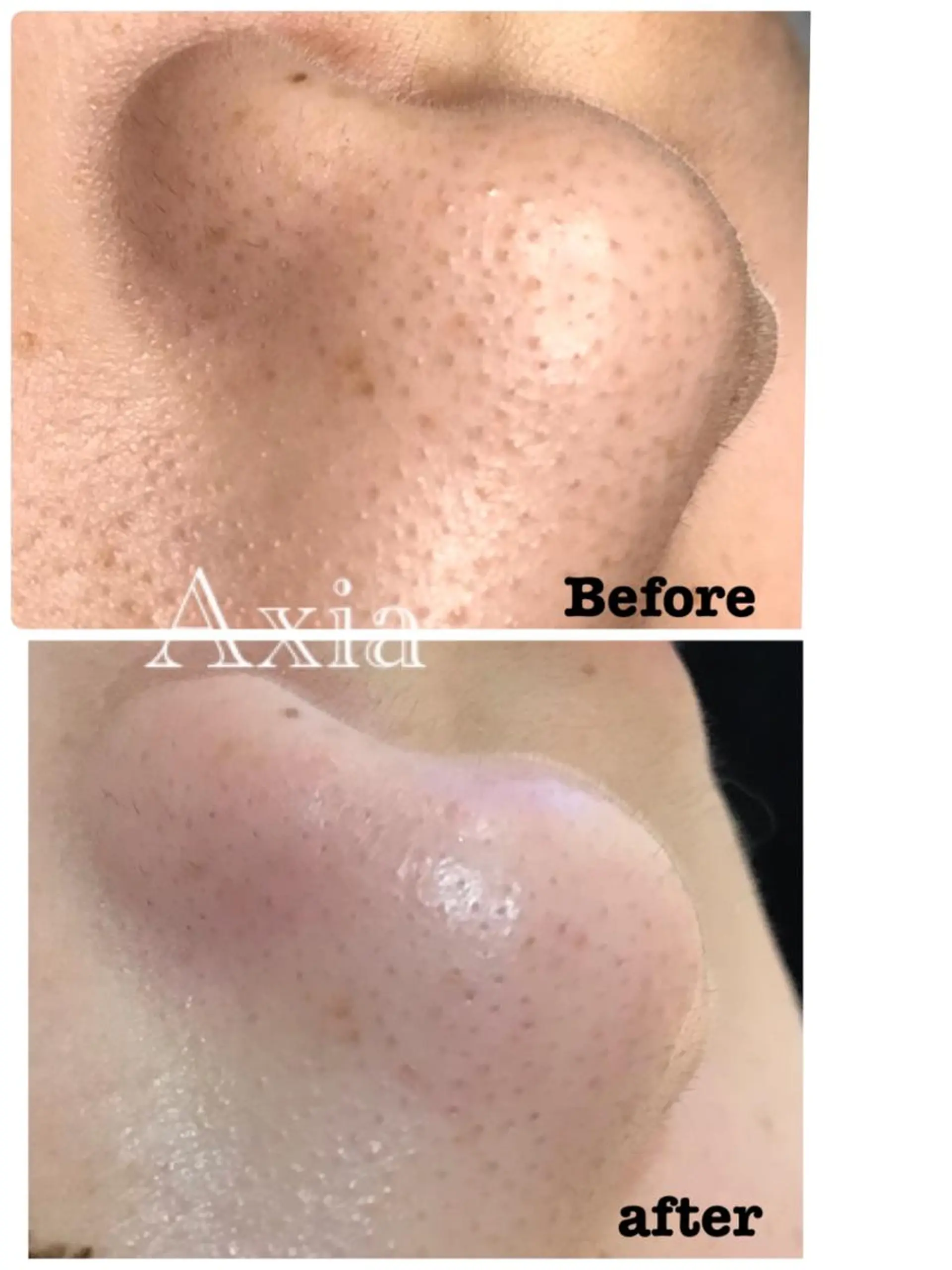 アクシア ビューティー サロン所属・究極のアンチエイ ジングサロンのエステ・リラクイメージ