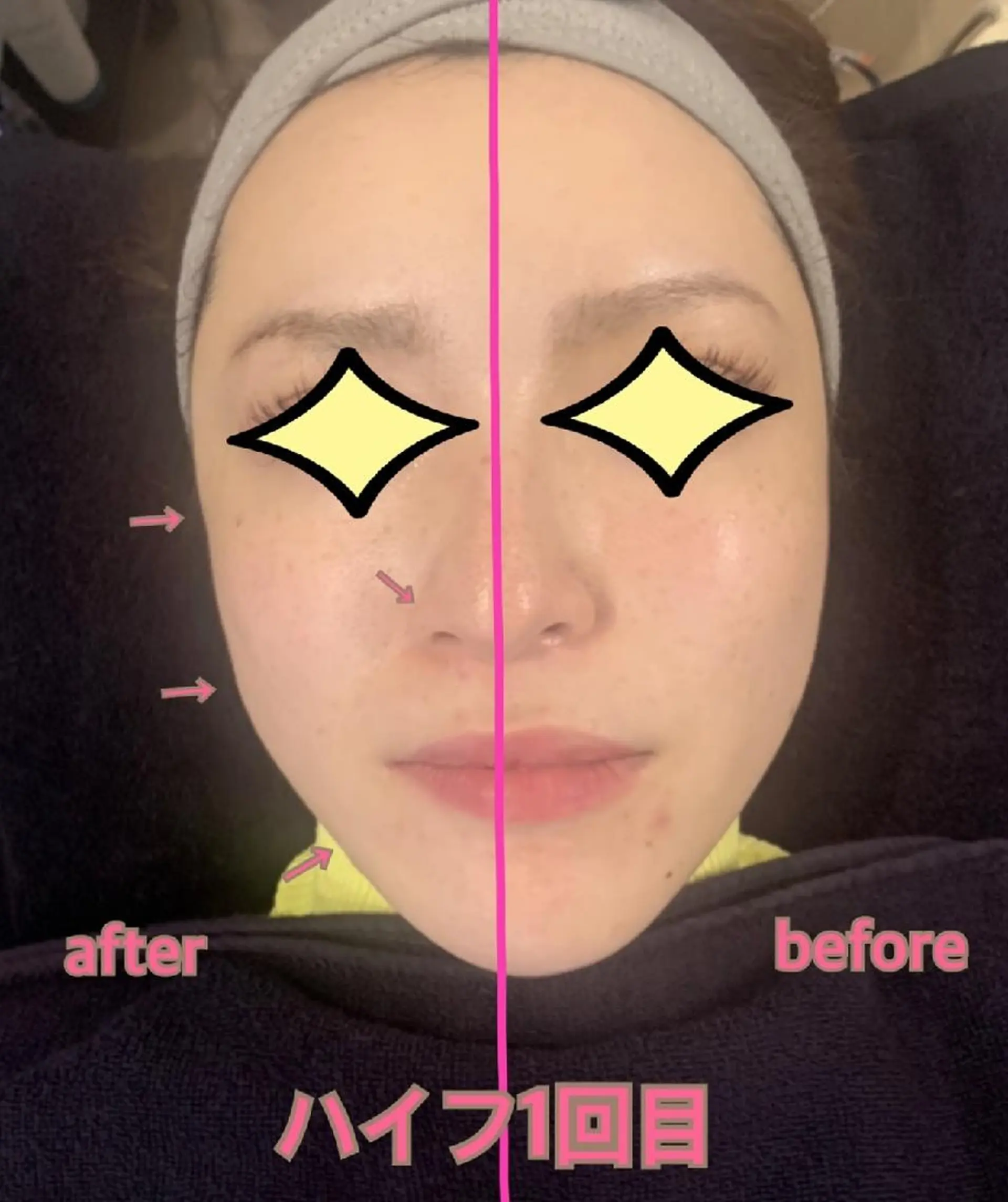 SESUNNY セサニー SEIRAのマツエク・マツパデザイン