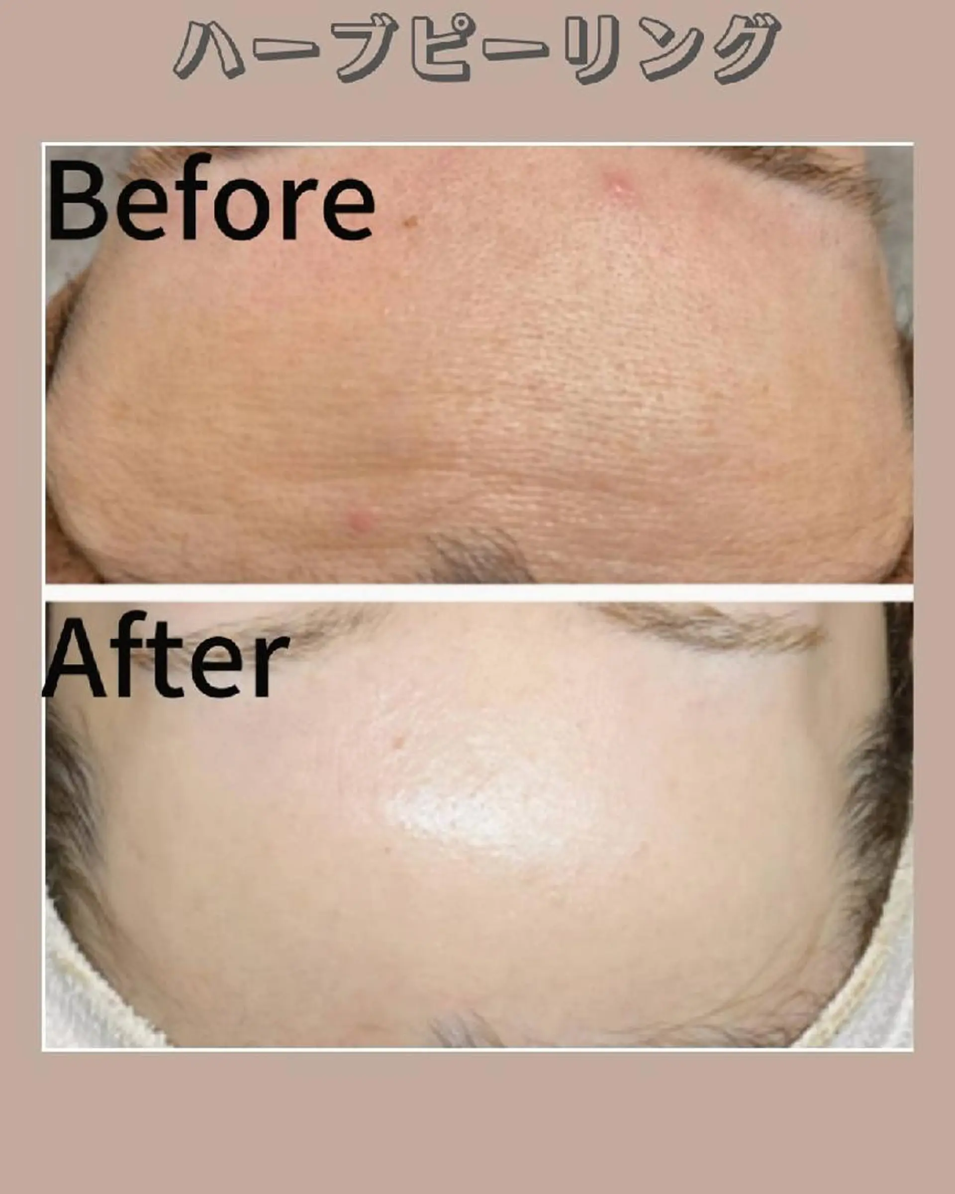 Facial Salon LUIRE所属・LUIRE　 ルイールのエステ・リラクイメージ