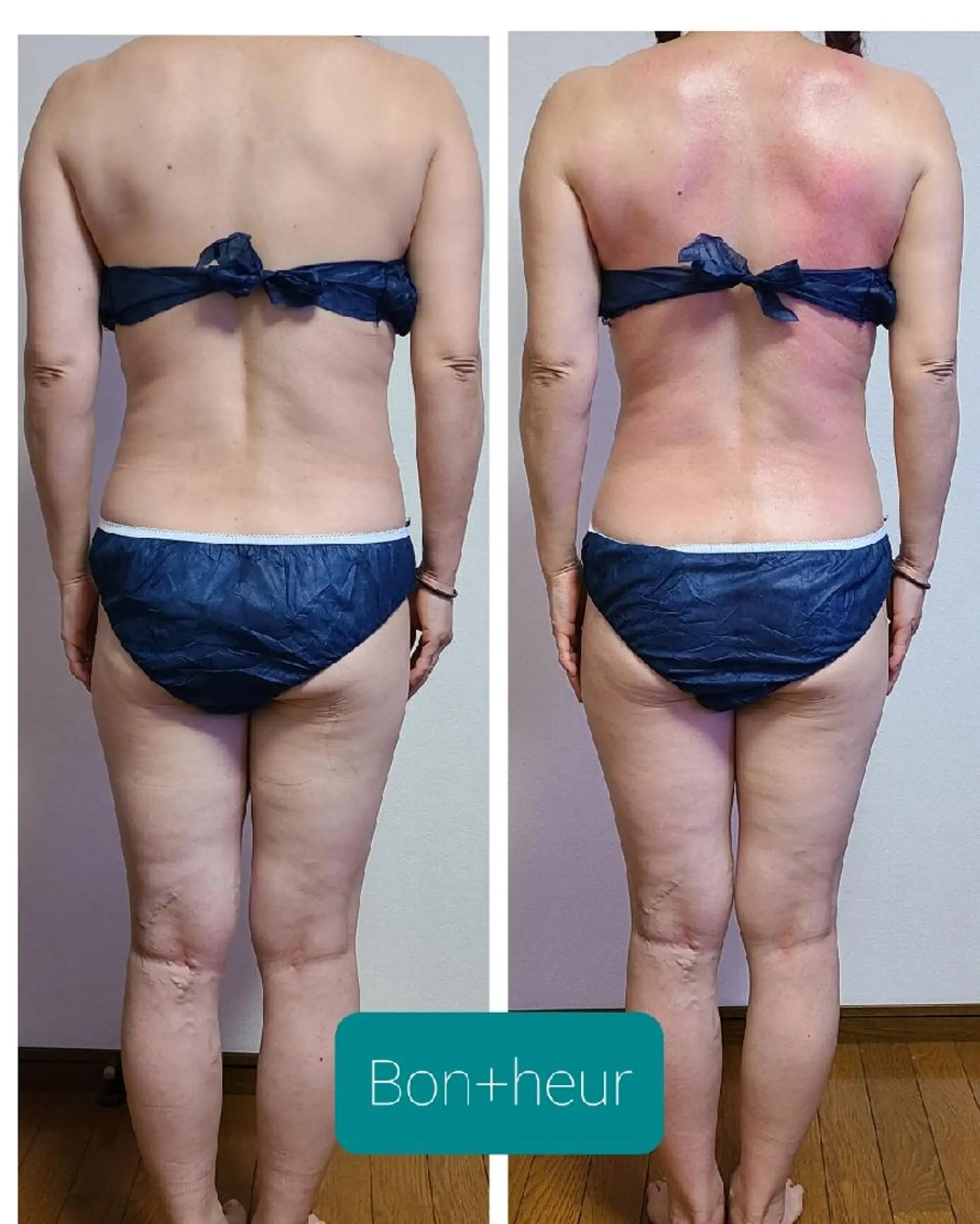 エステ 宮口 紗子のネイルデザイン