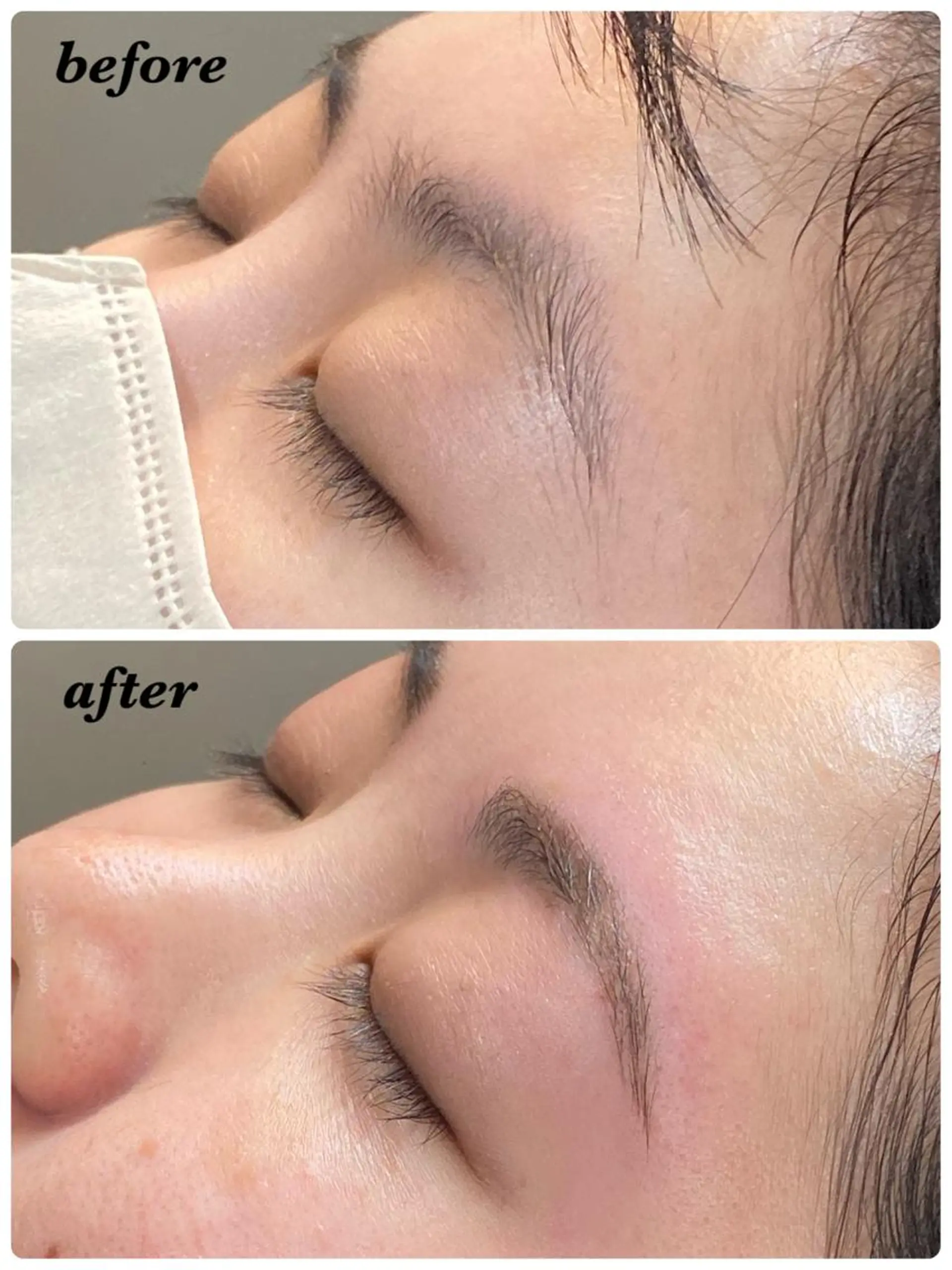 アイブロウ ハーブピーリング/韓国肌管理/フェイシャル/毛穴洗浄/眉毛/顔脱毛【糸脱毛専門】rev所属・ハーブピーリング🌹 毛穴洗浄❤️眉waxのエステ・リラクイメージ