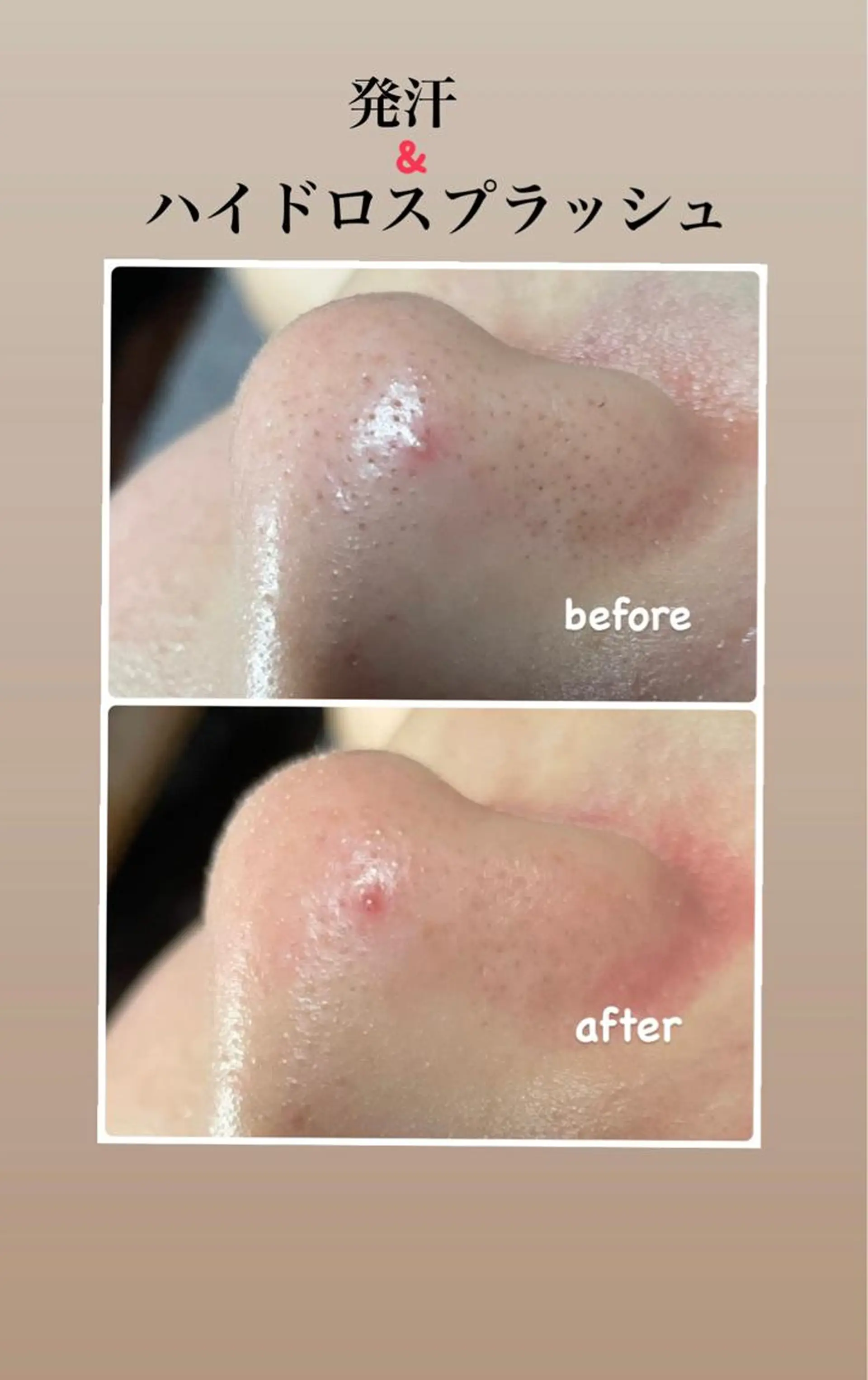 エステ エステ／ネイル/脱毛 R.Msalonのネイルデザイン