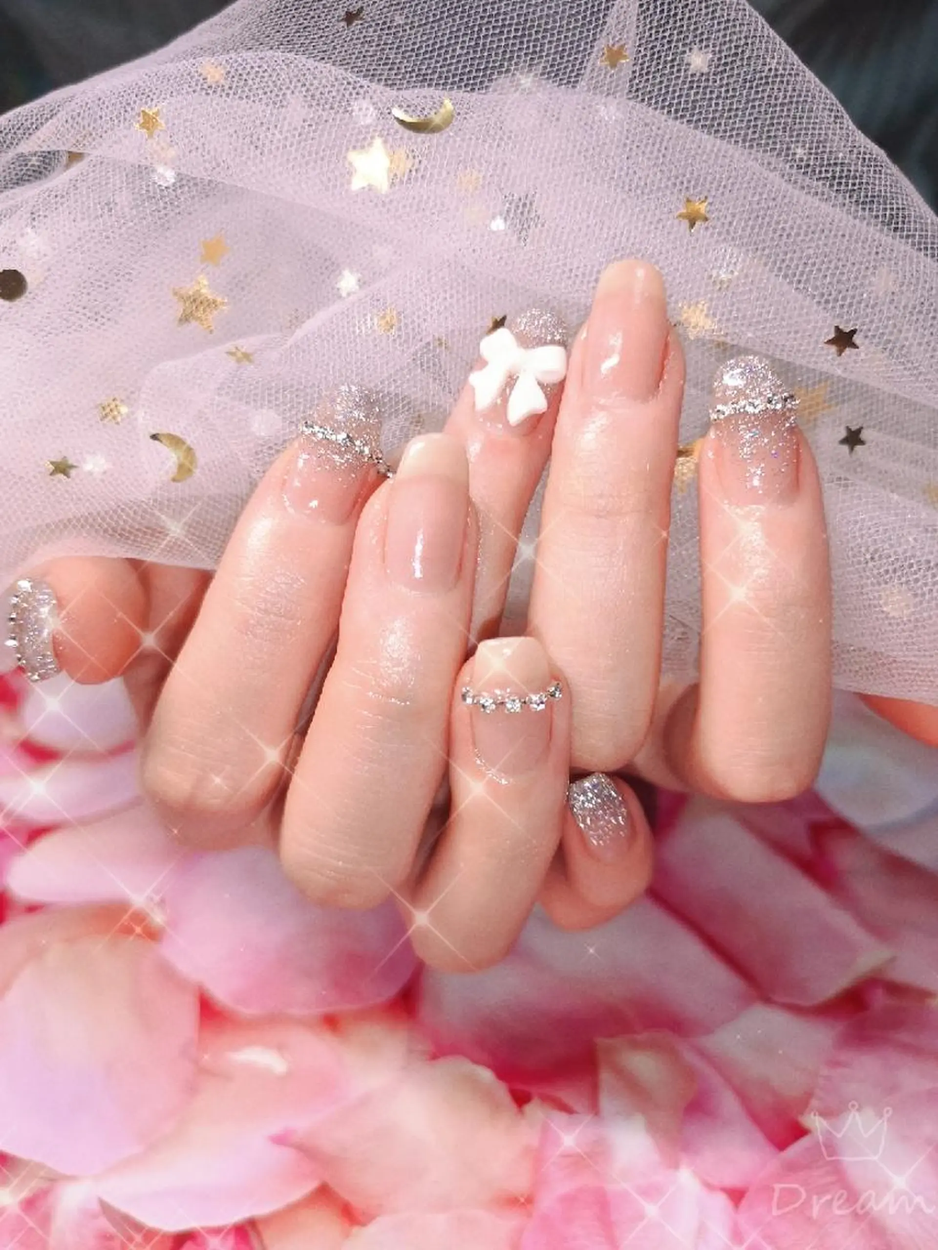 ミディアム ネイル ワンホンネイル ハンドネイル ネイリストゆか💅 長さだし、深爪矯正のネイルデザイン