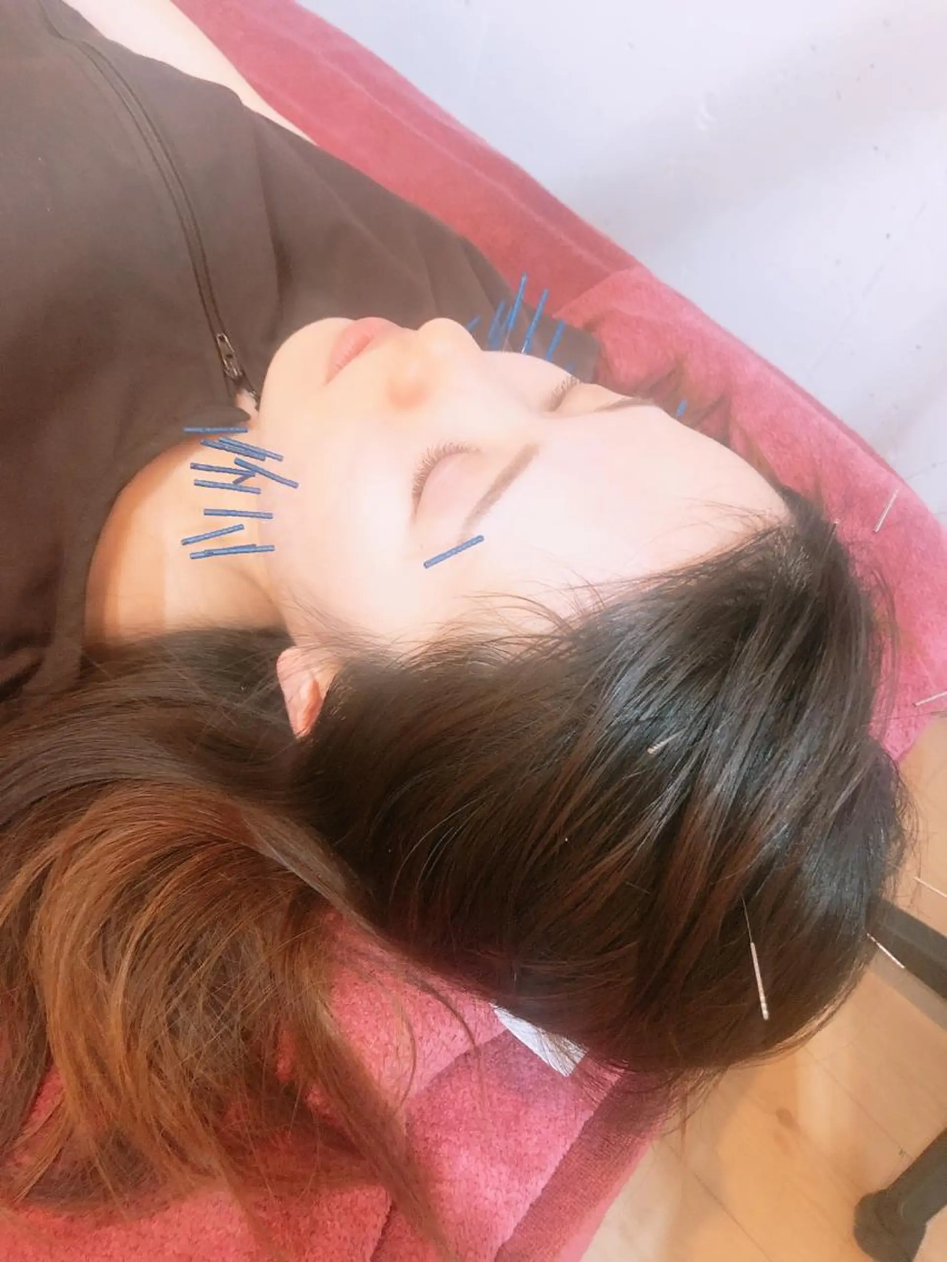 美容鍼灸女性専用 りんご鍼灸治療院のエステ・リラクイメージ