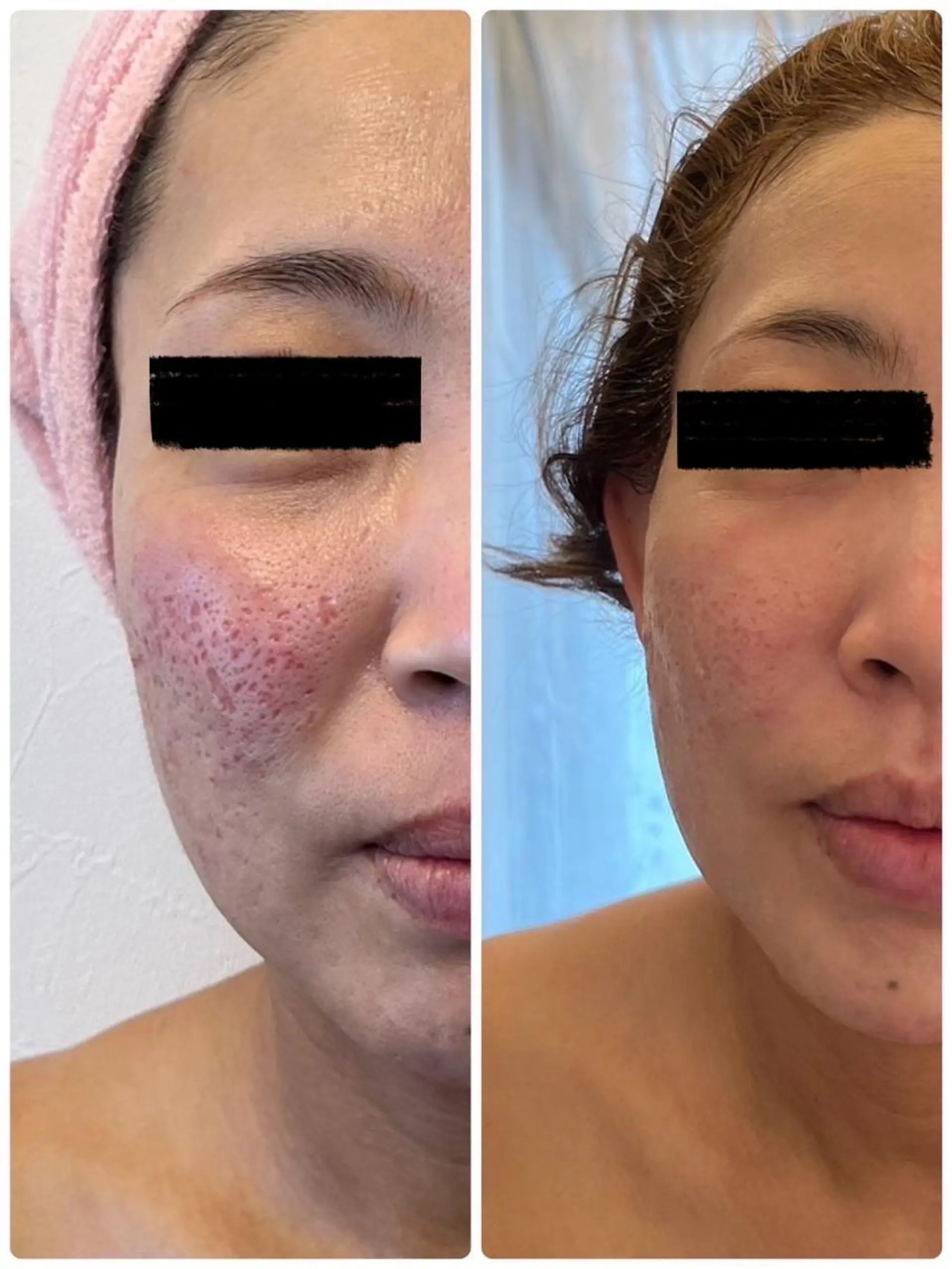 BLESS BEAUTYのエステ・リラクイメージ