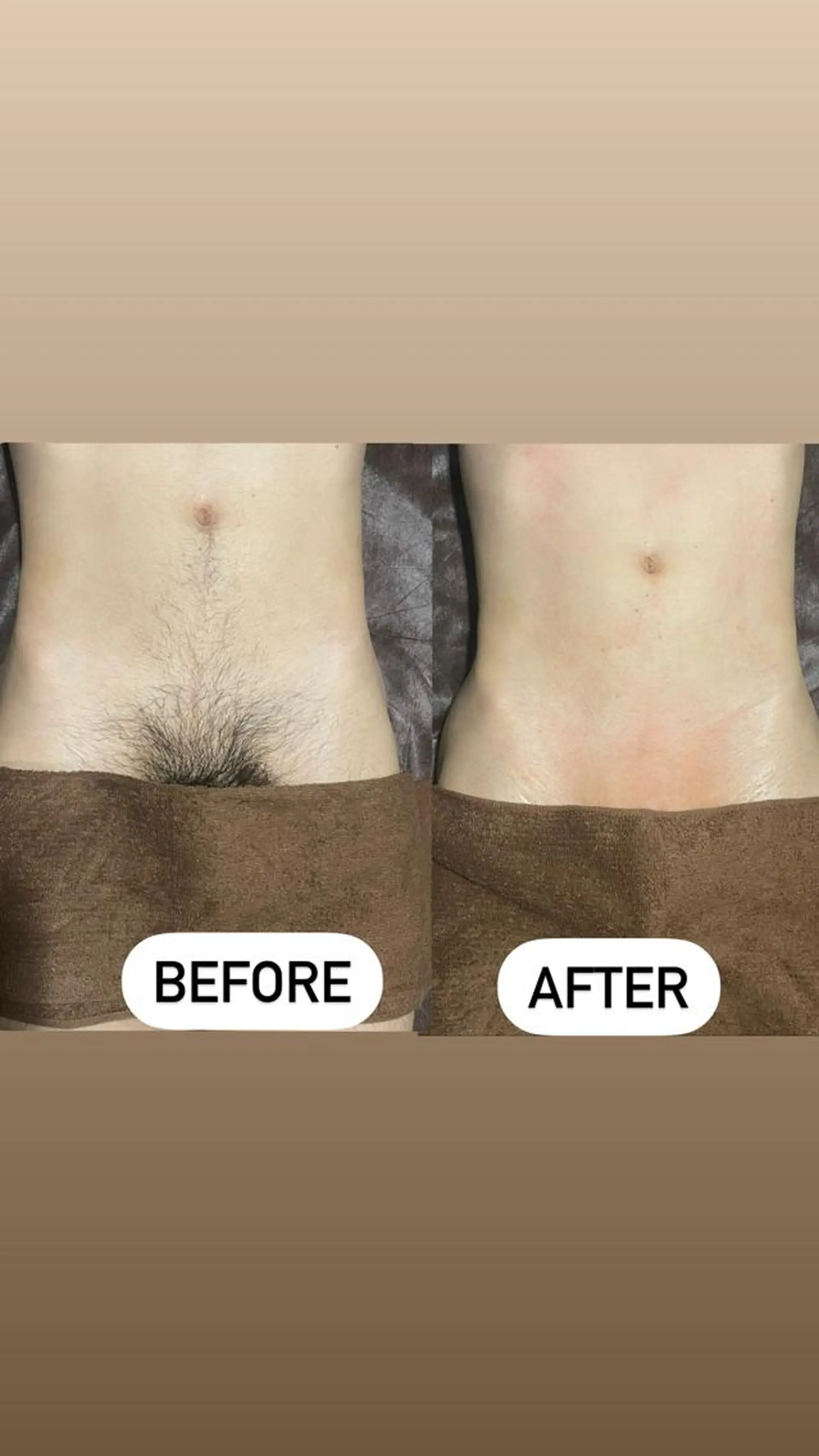 メンズ 脱毛 メンズ眉毛ITSUK Iメンズ専門　新宿の眉毛・アイブロウイメージ