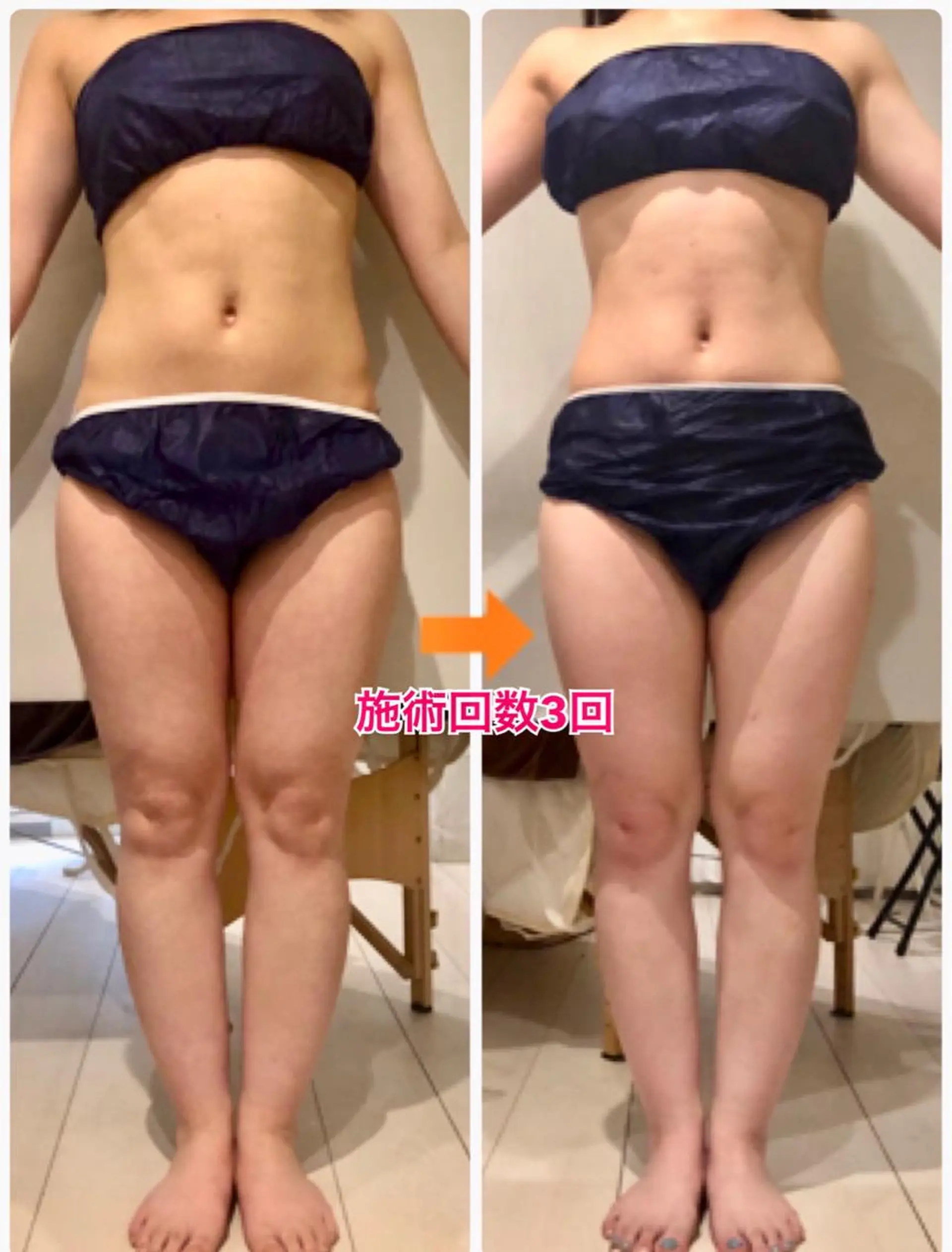 ロング カラー パーマ ヘアアレンジ メンズ キッズ ネイル マツエク・マツパ ‍痩身＆ボディ 結果出し🌟丹野のエステ・リラクイメージ