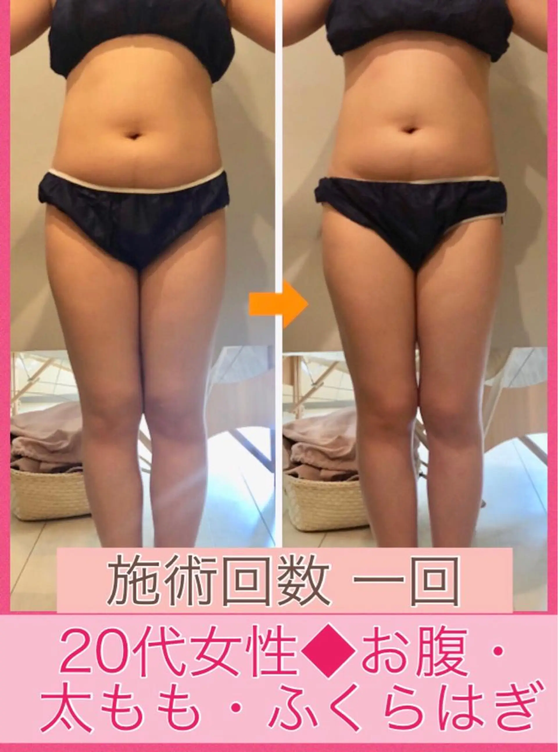 ミディアム カラー パーマ ヘアアレンジ メンズ キッズ ネイル マツエク・マツパ ‍痩身＆ボディ 結果出し🌟丹野のエステ・リラクイメージ