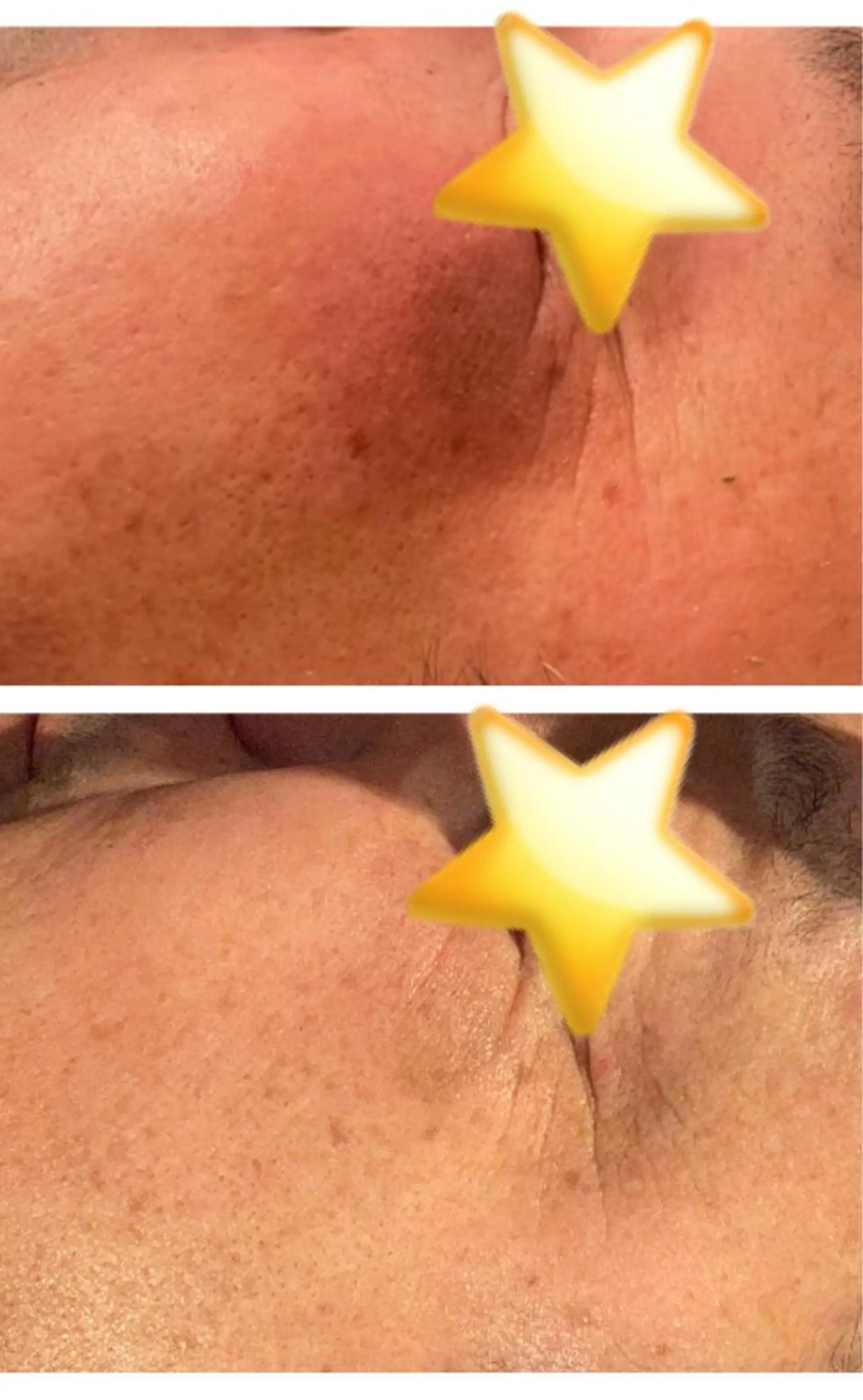 Remina clinical salon所属・ハイフ美肌専門 Remina.c.sのエステ・リラクイメージ