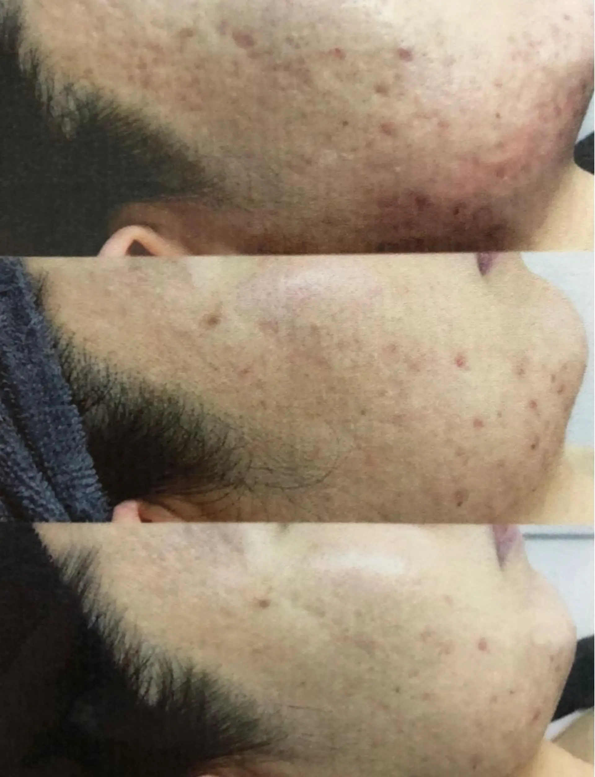 ALIA Scintiller  アリアサンティエ所属・齋藤 祐里耶のエステ・リラクイメージ