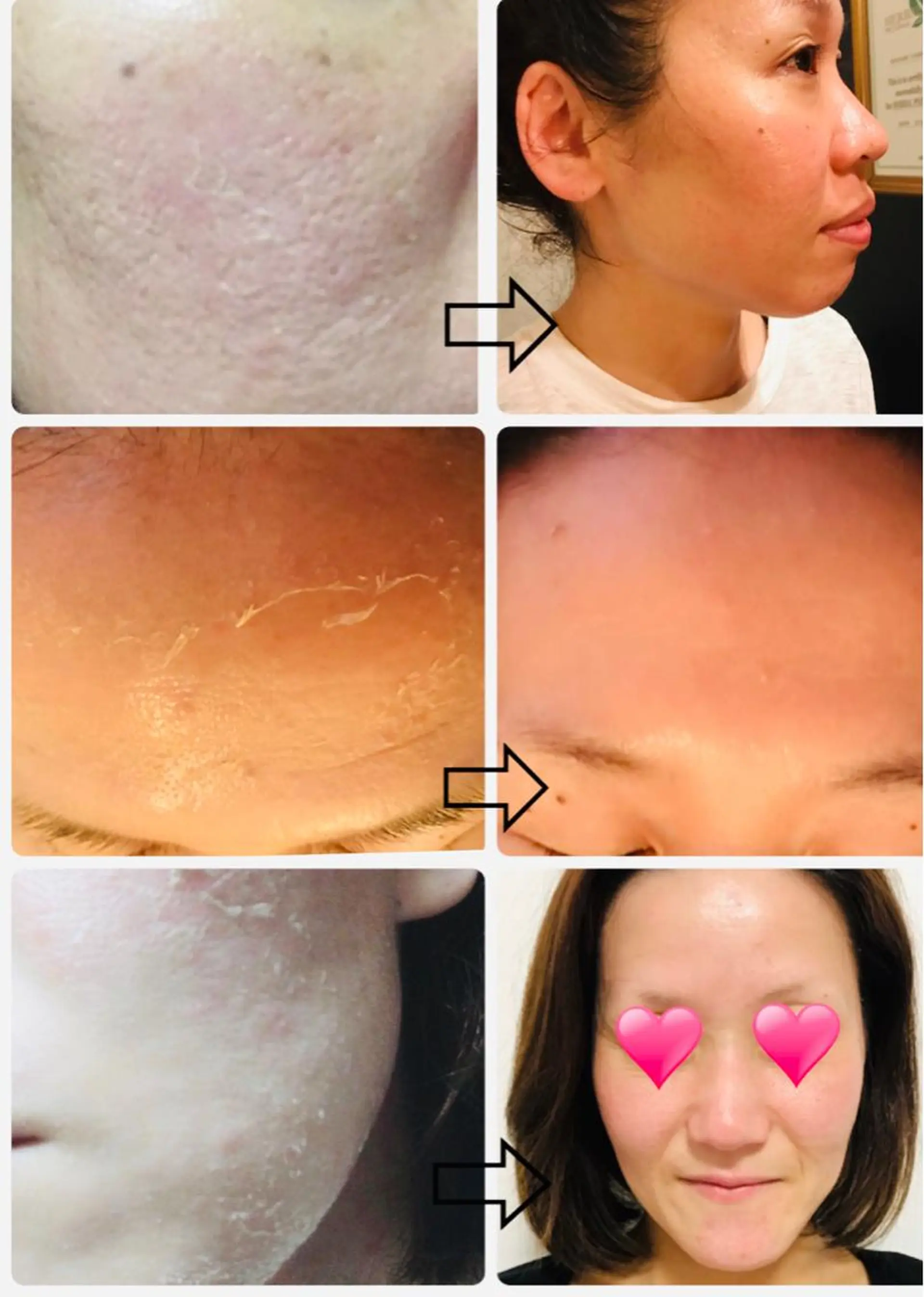 アクシア ビューティー サロン所属・究極のアンチエイ ジングサロンのエステ・リラクイメージ