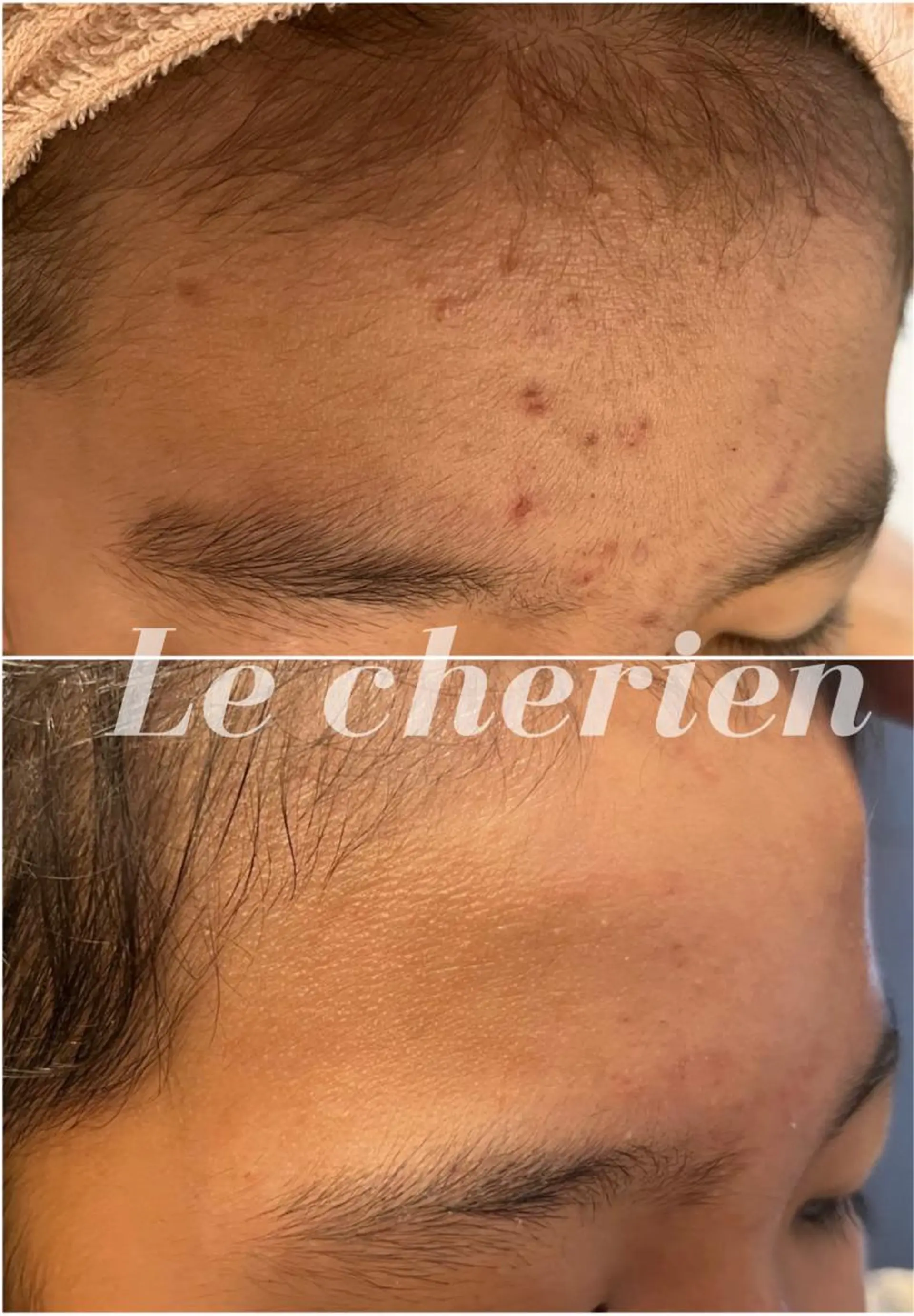 エステ Le cherien所属・Le cherien ルシェリアのエステ・リラクイメージ