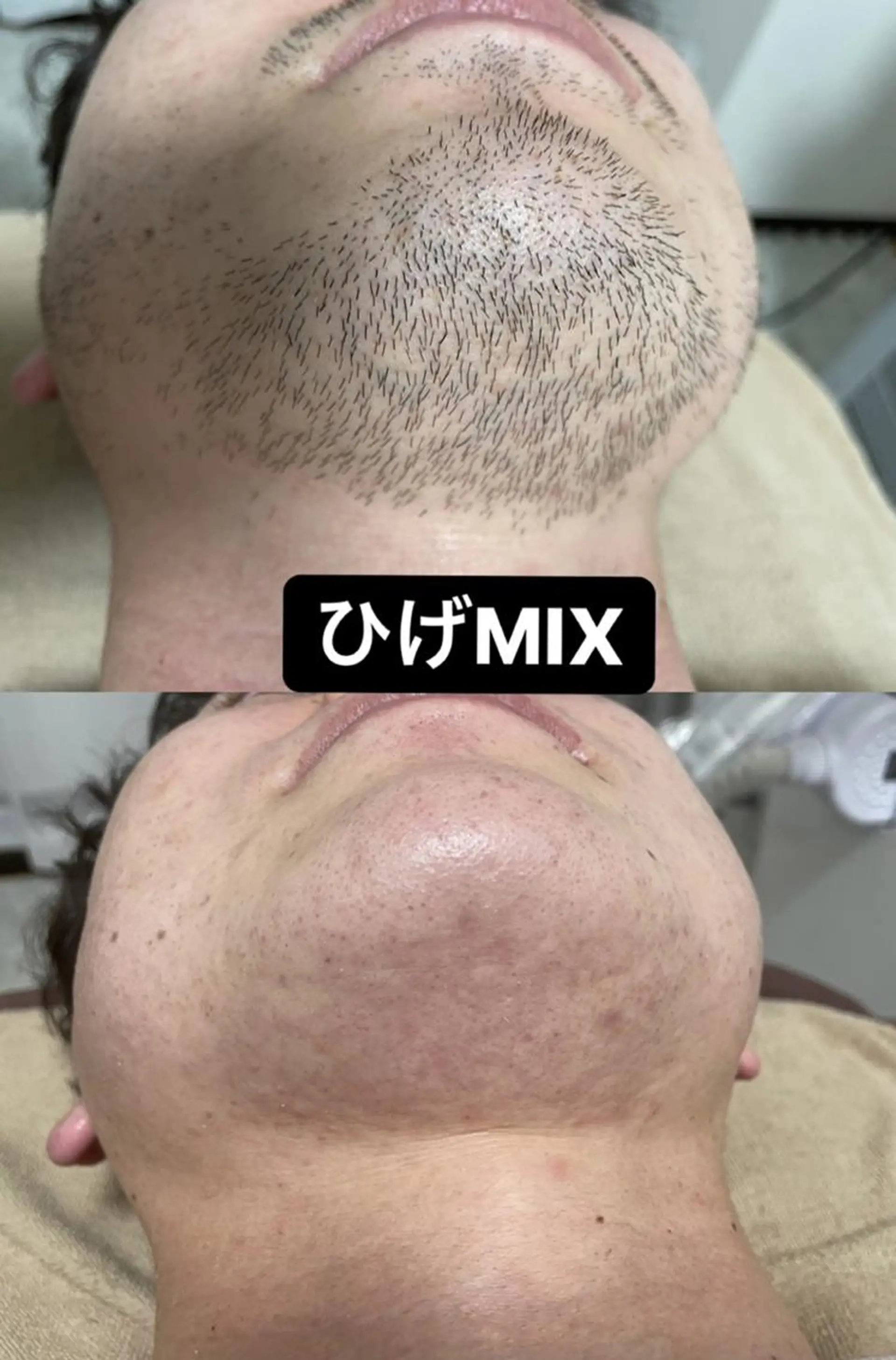 キッズ メンズ 脱毛 Epina 千葉店 【エピナ】のエステ・リラクイメージ