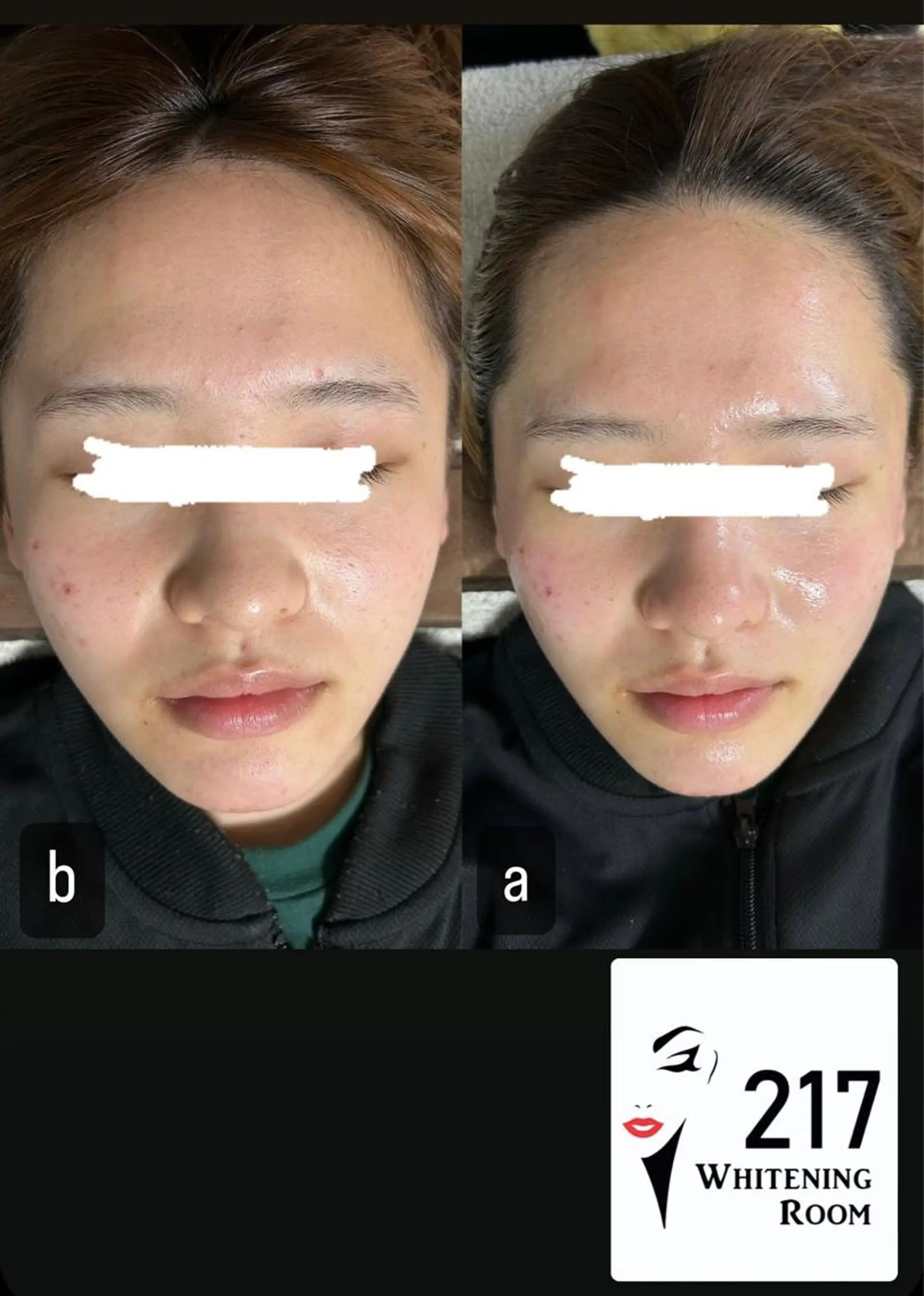 217whitening  room所属・217 ホワイトニングルームのエステ・リラクイメージ