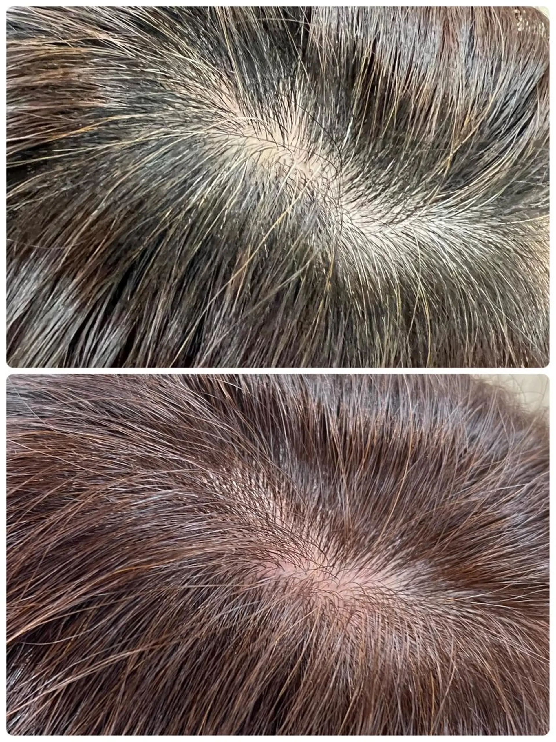 ミディアム ウカデミーライブ所属・仲川 礼のヘアスタイル