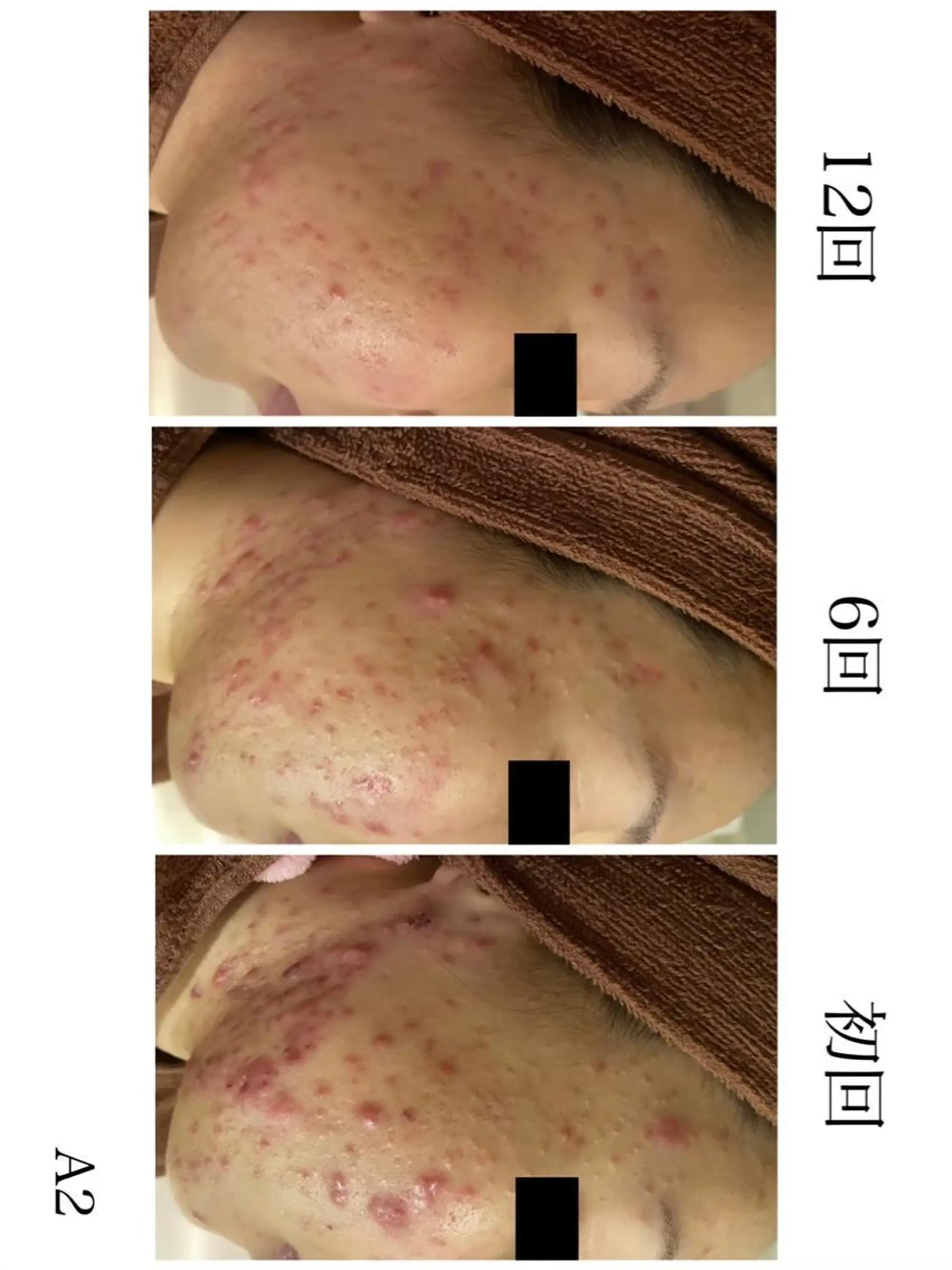 セミロング カラー パーマ ヘアアレンジ メンズ キッズ ネイル マツエク・マツパ アイブロウ 夏までに肌荒れ卒業 するサロン🌻のエステ・リラクイメージ