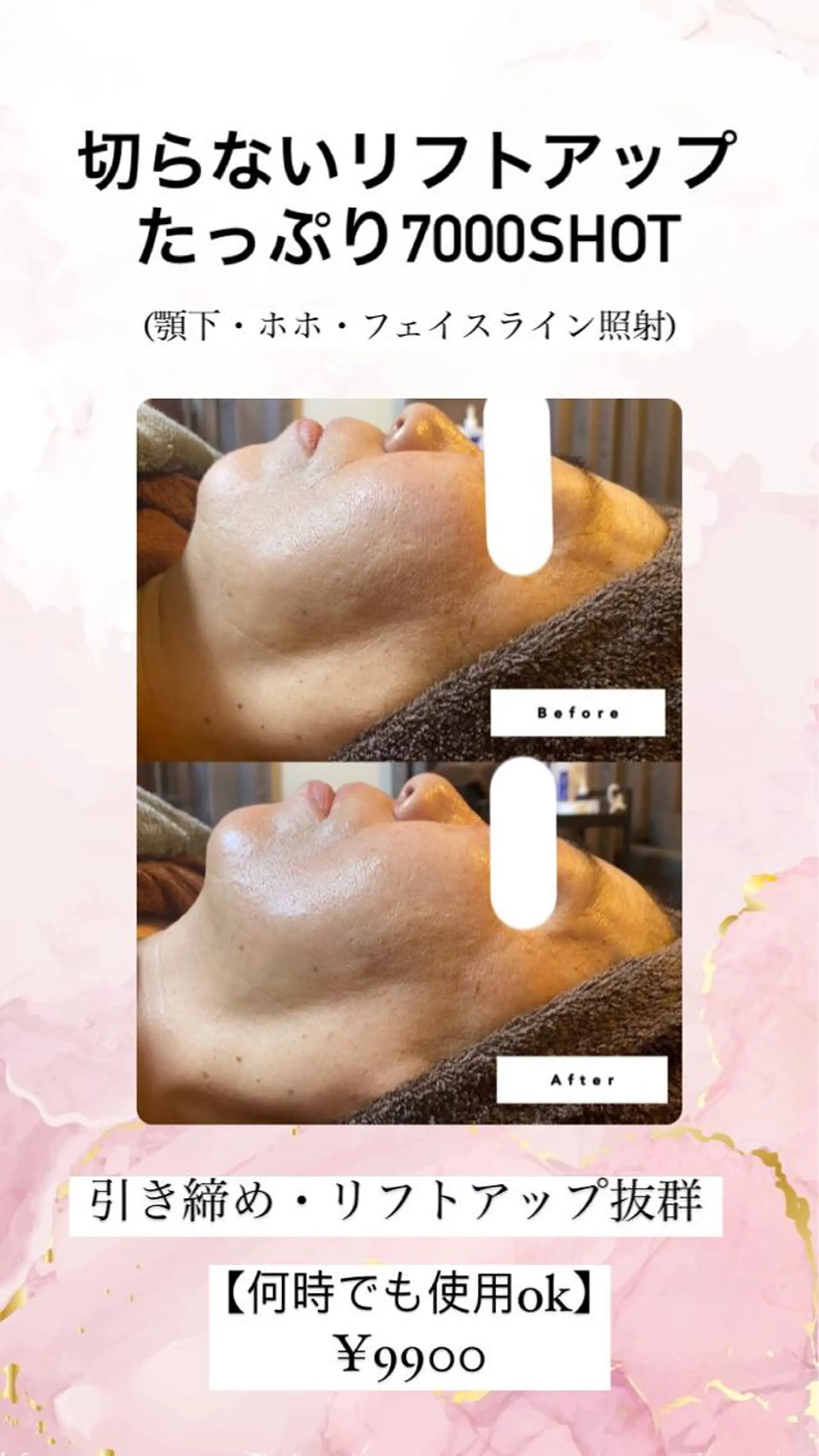 セミロング カラー パーマ ヘアアレンジ メンズ キッズ ネイル マツエク・マツパ アイブロウ 小顔カット Chloe-クロエ- 脱毛/フェイシャルのエステ・リラクイメージ