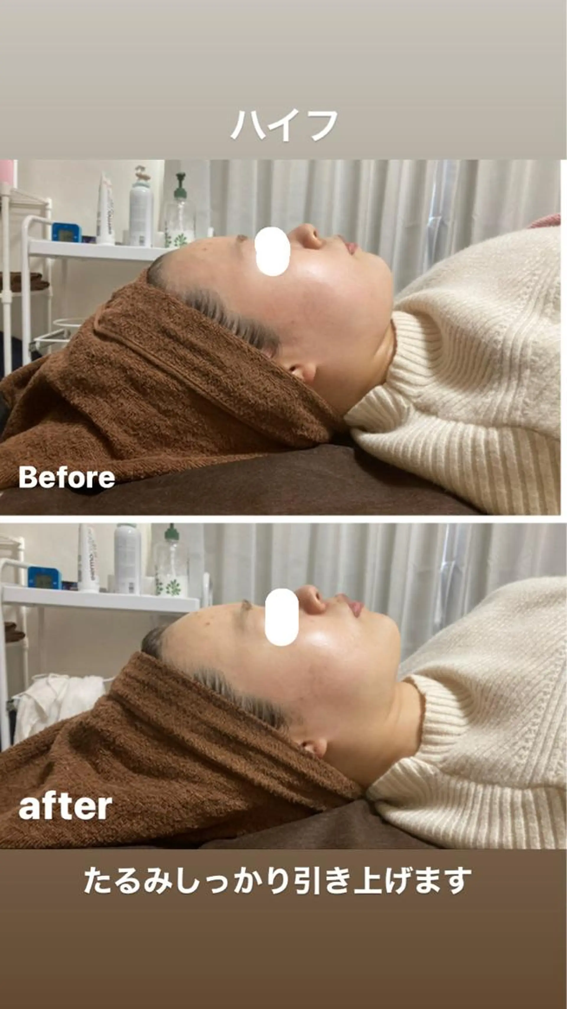 エステ 美顔秘密基地新宮所属・美顔秘密基地 新宮のその他イメージ