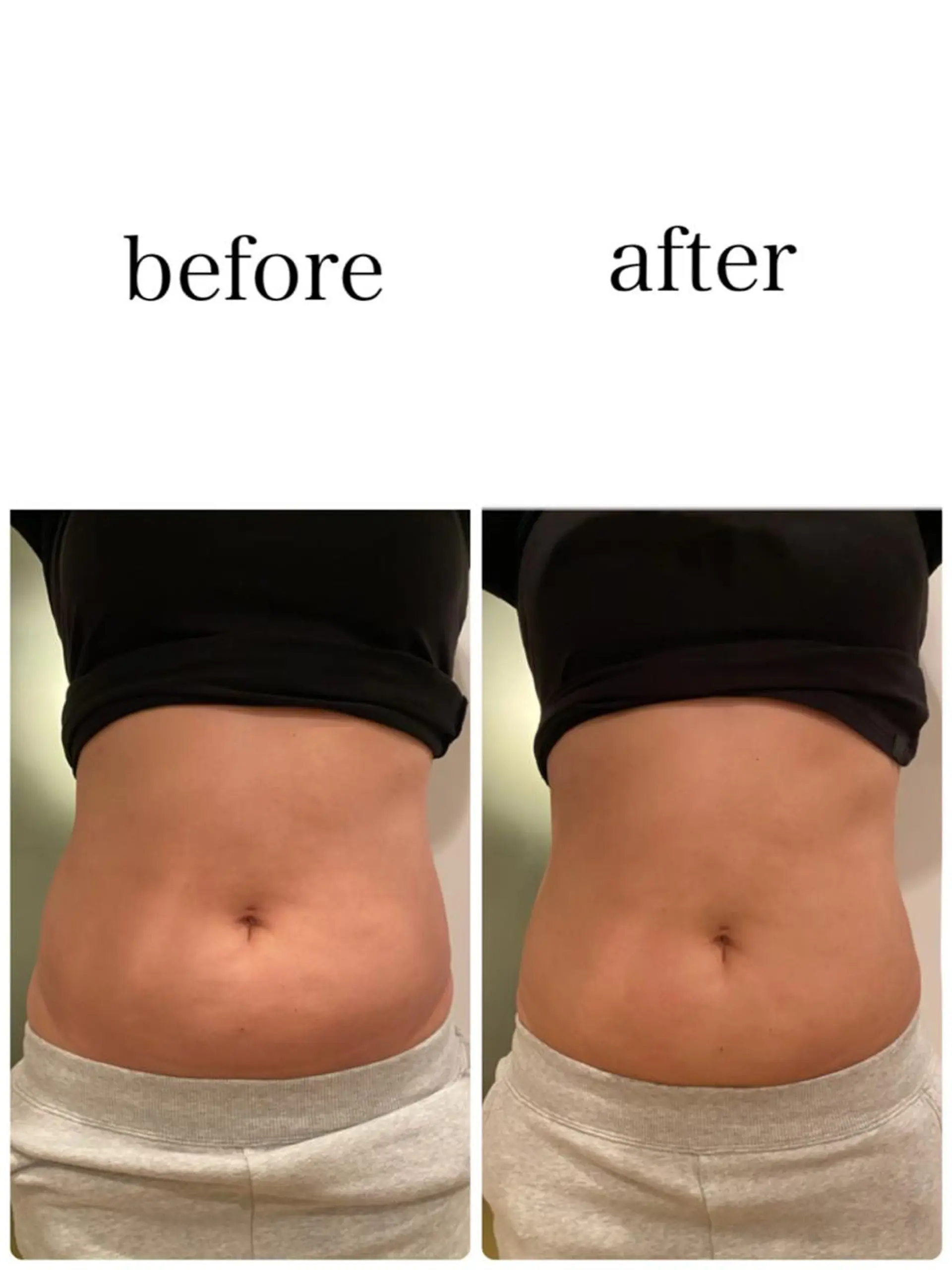 エステ 姿勢改善&beauty salon LAUB所属・姿勢改善 サロンLAUB奥村のエステ・リラクイメージ