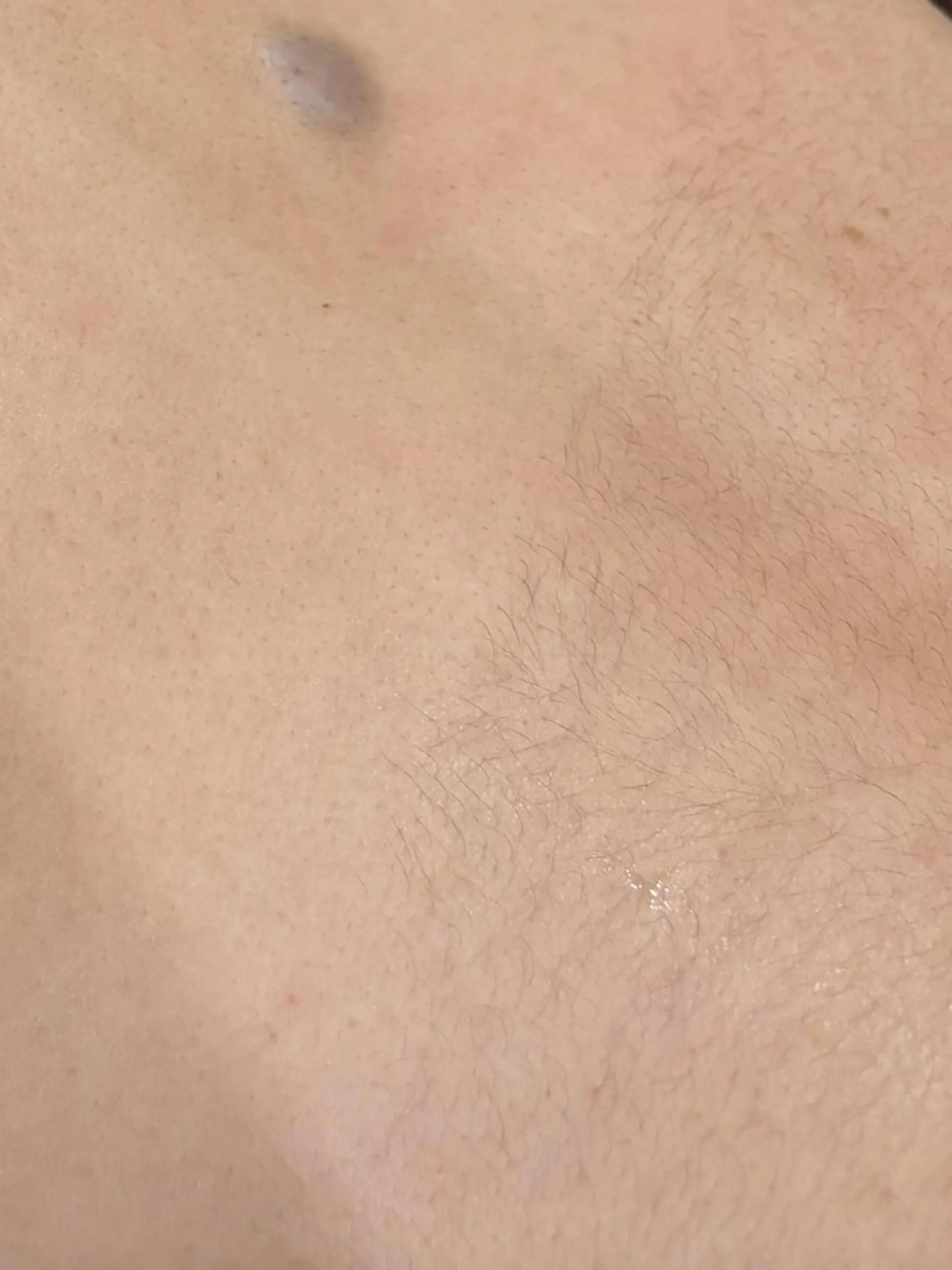 脱毛 🖤RAYVIS🖤 青森店　山内のエステ・リラクイメージ