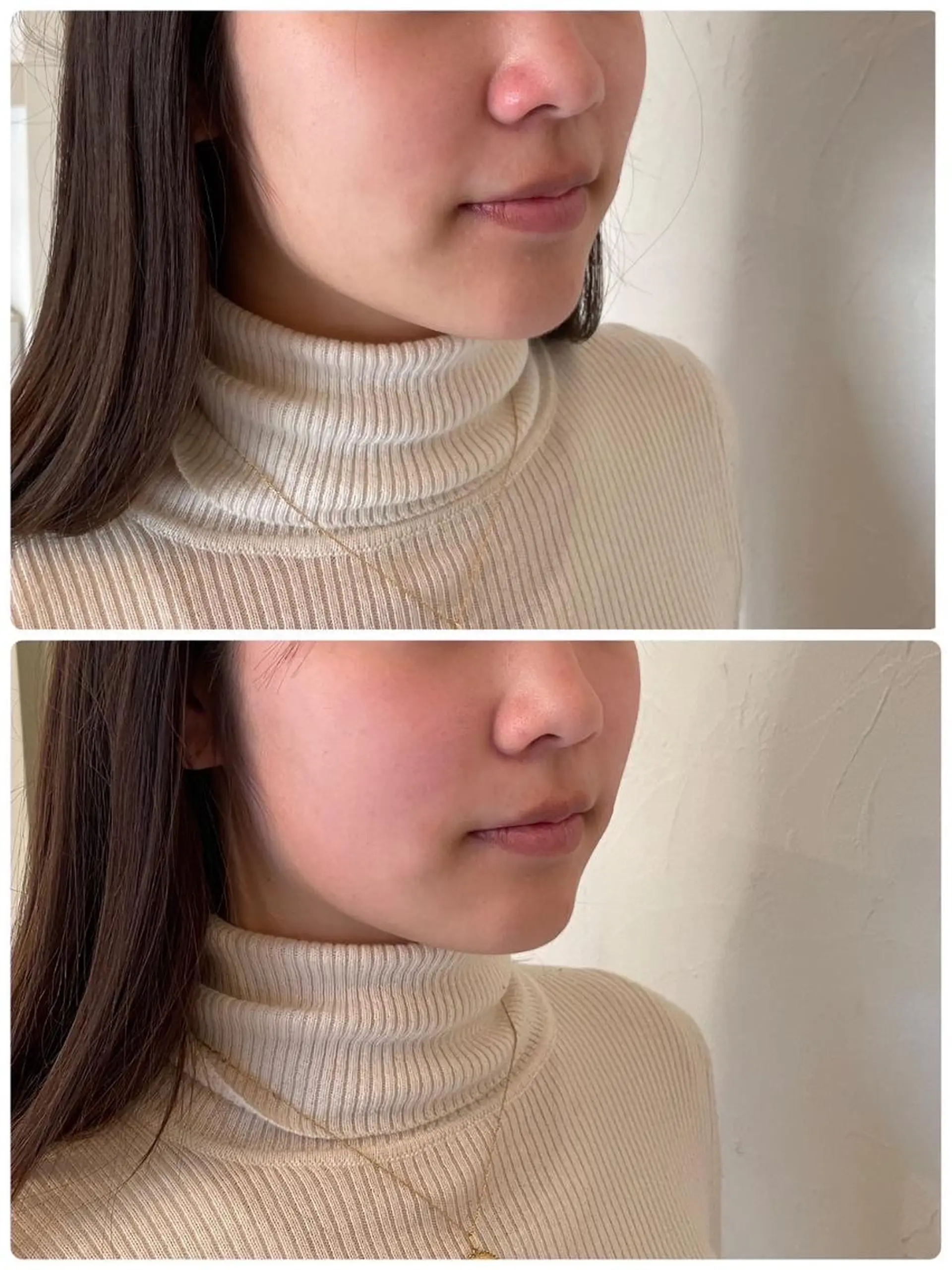 エステ リラク 盛れる小顔矯正師 たく先生のエステ・リラクイメージ