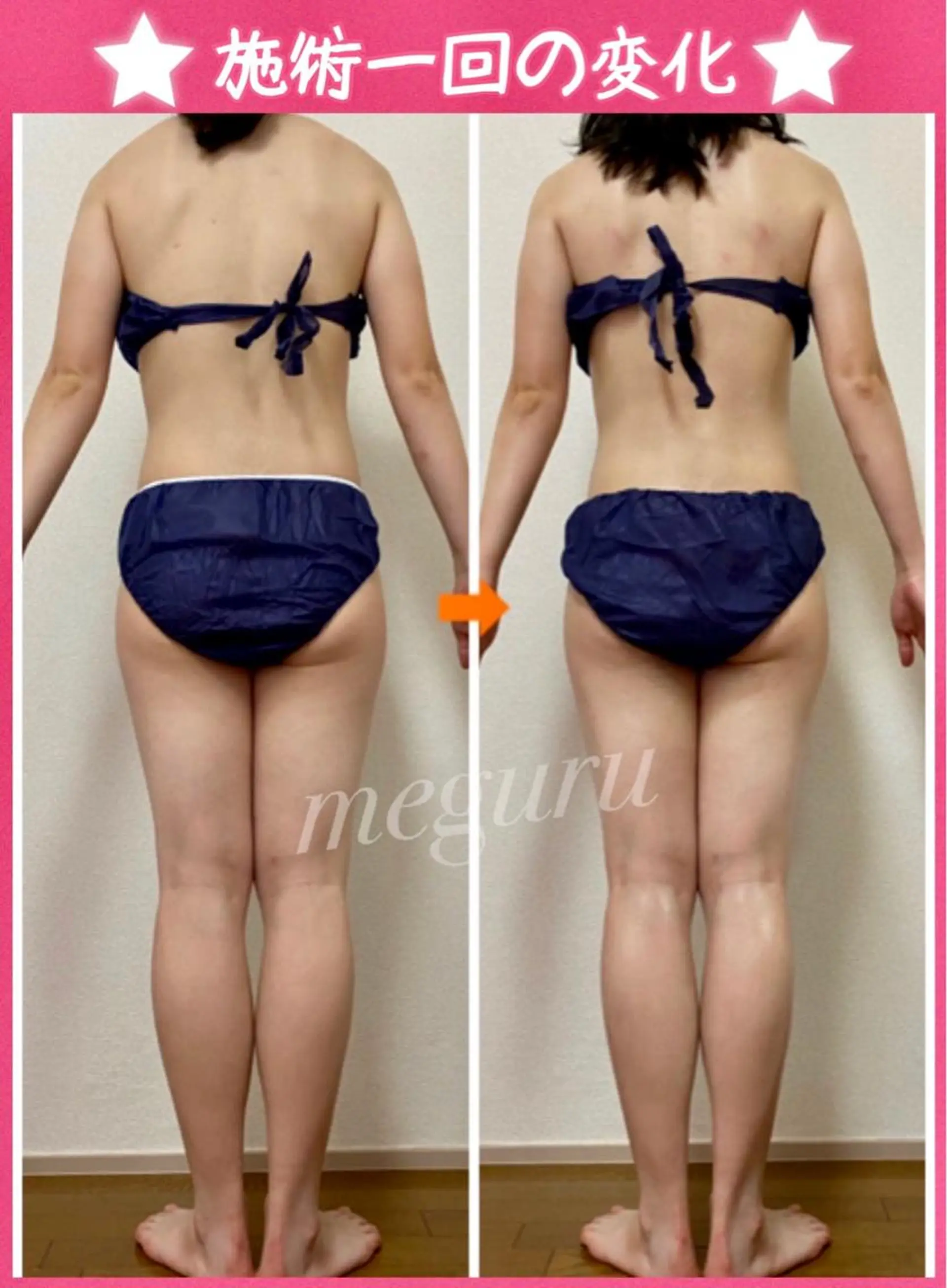 ショート カラー パーマ ヘアアレンジ メンズ キッズ ネイル マツエク・マツパ トリートメント エステ リラク 痩身&ボディ 結果出し🌟丹野のエステ・リラクイメージ