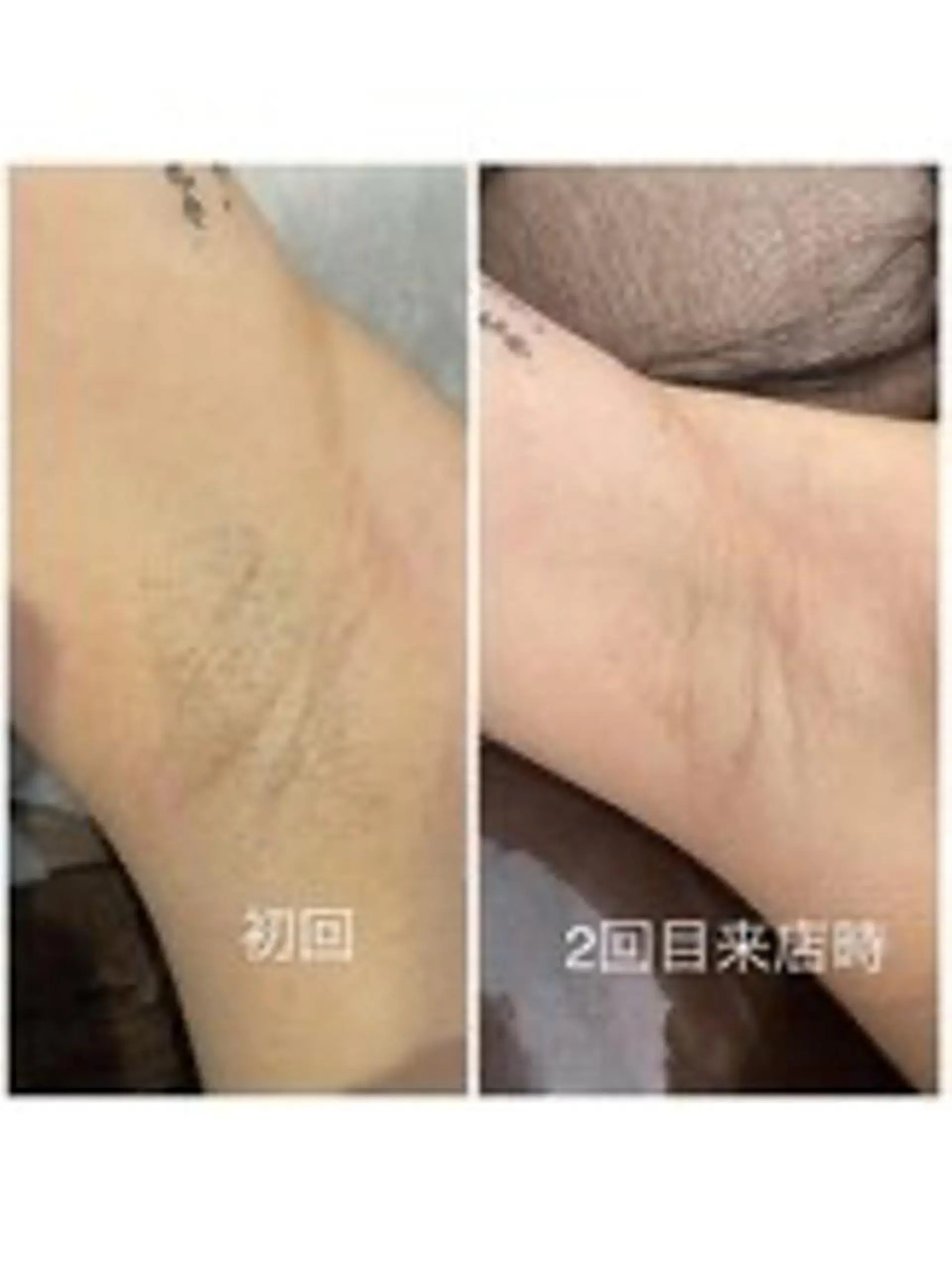 脱毛まつげサロン JESSICA荻窪店の眉毛・アイブロウイメージ