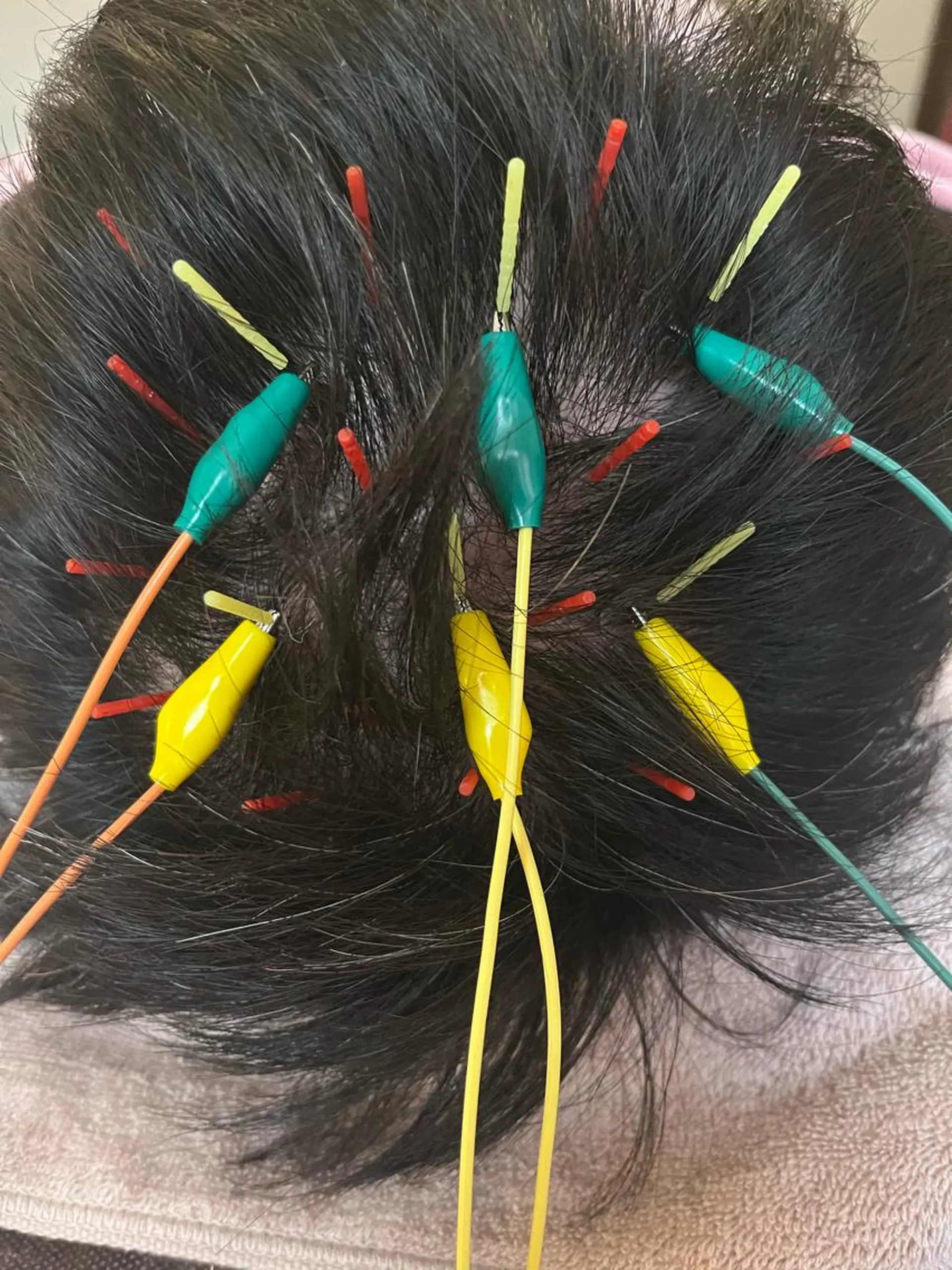 アロマ･美容鍼･カッ ピング「麗」鍼灸院のエステ・リラクイメージ