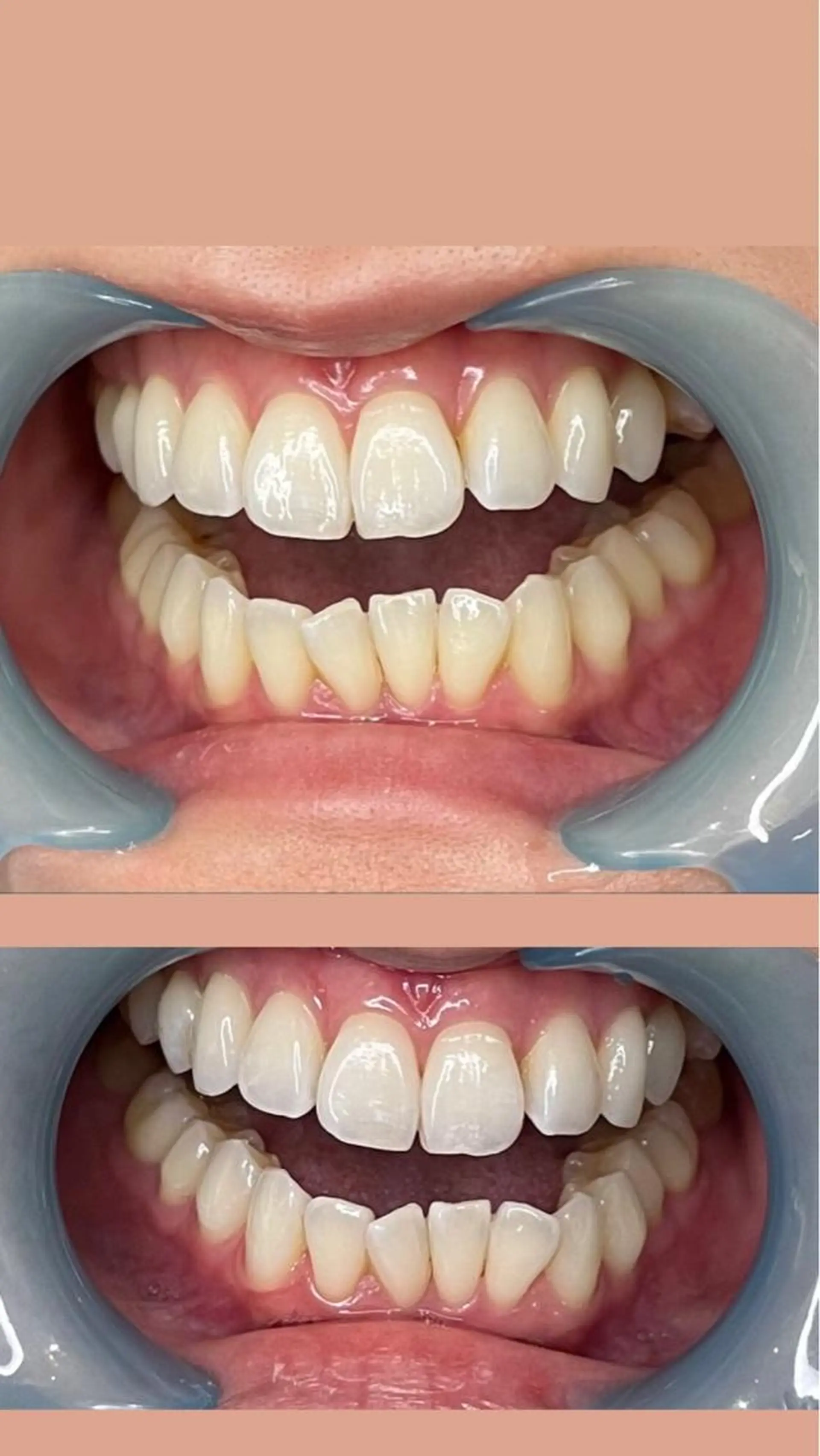 LAVISH nail salonのネイルデザイン