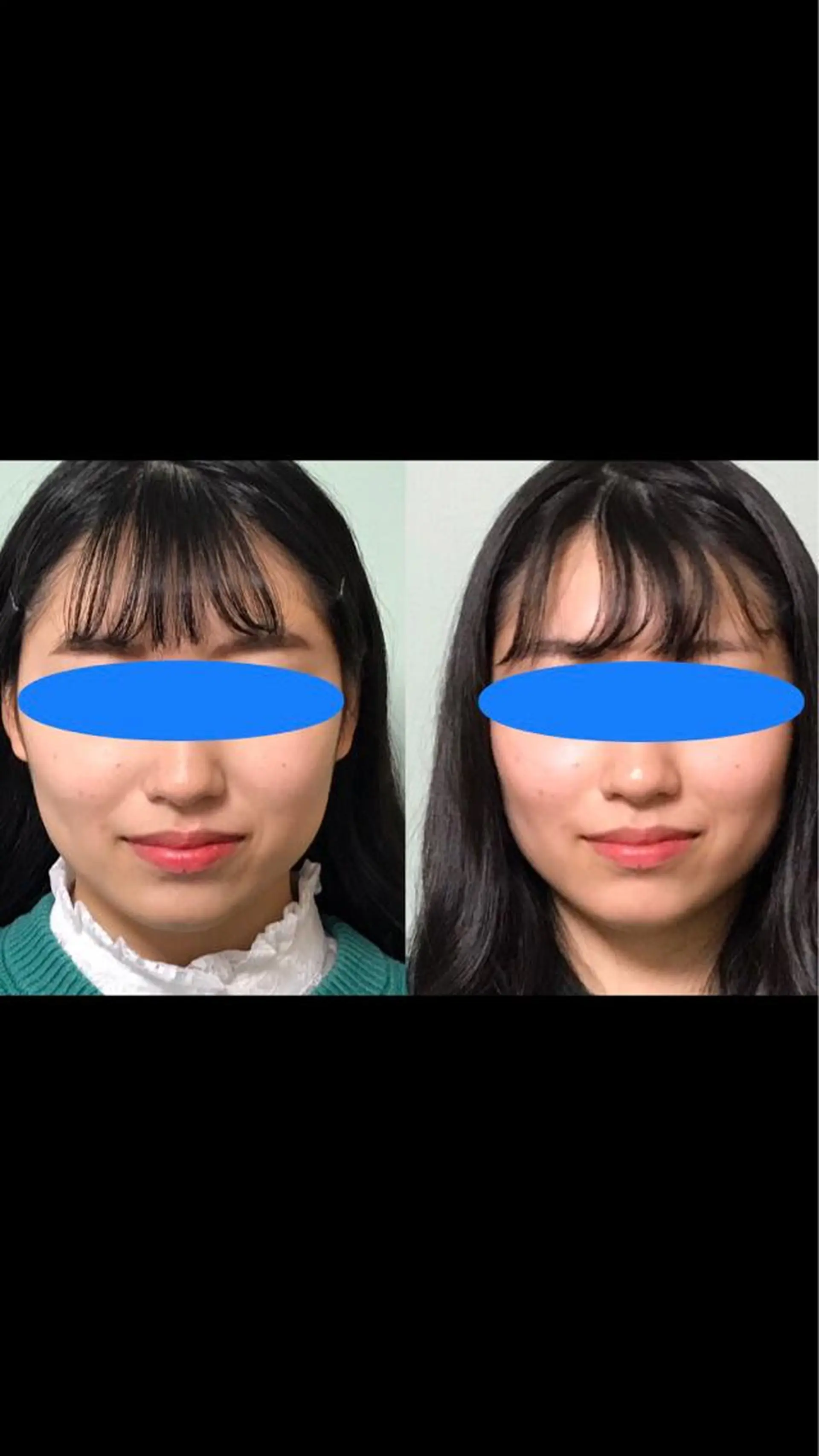 エステ リラク 春日井トータルからだ サロンふくふくのエステ・リラクイメージ