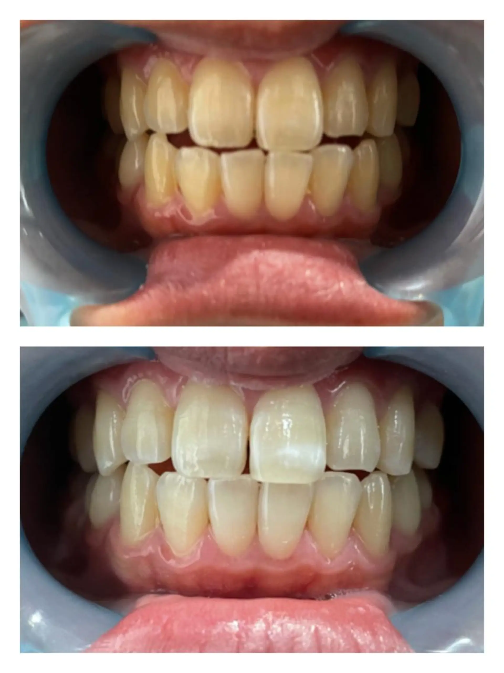 SESUNNY セサ二ー　SAYAのマツエク・マツパデザイン