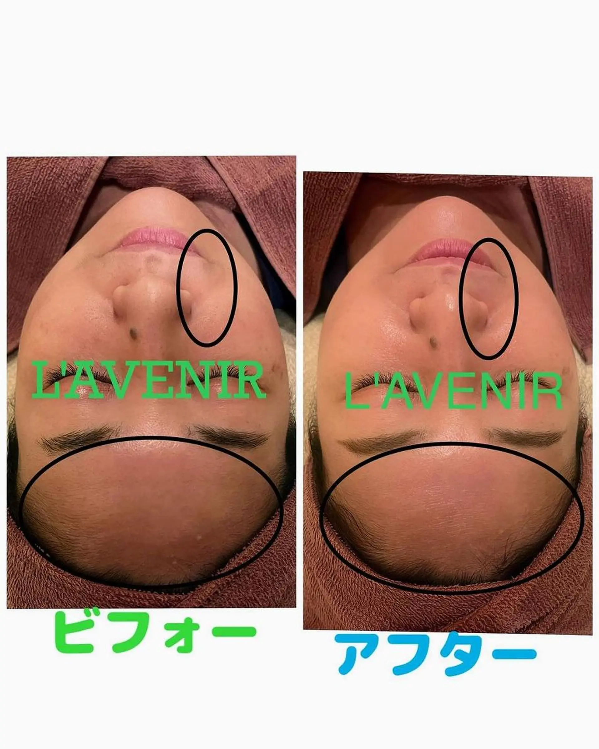 ラブニール 恵比寿店のエステ・リラクイメージ