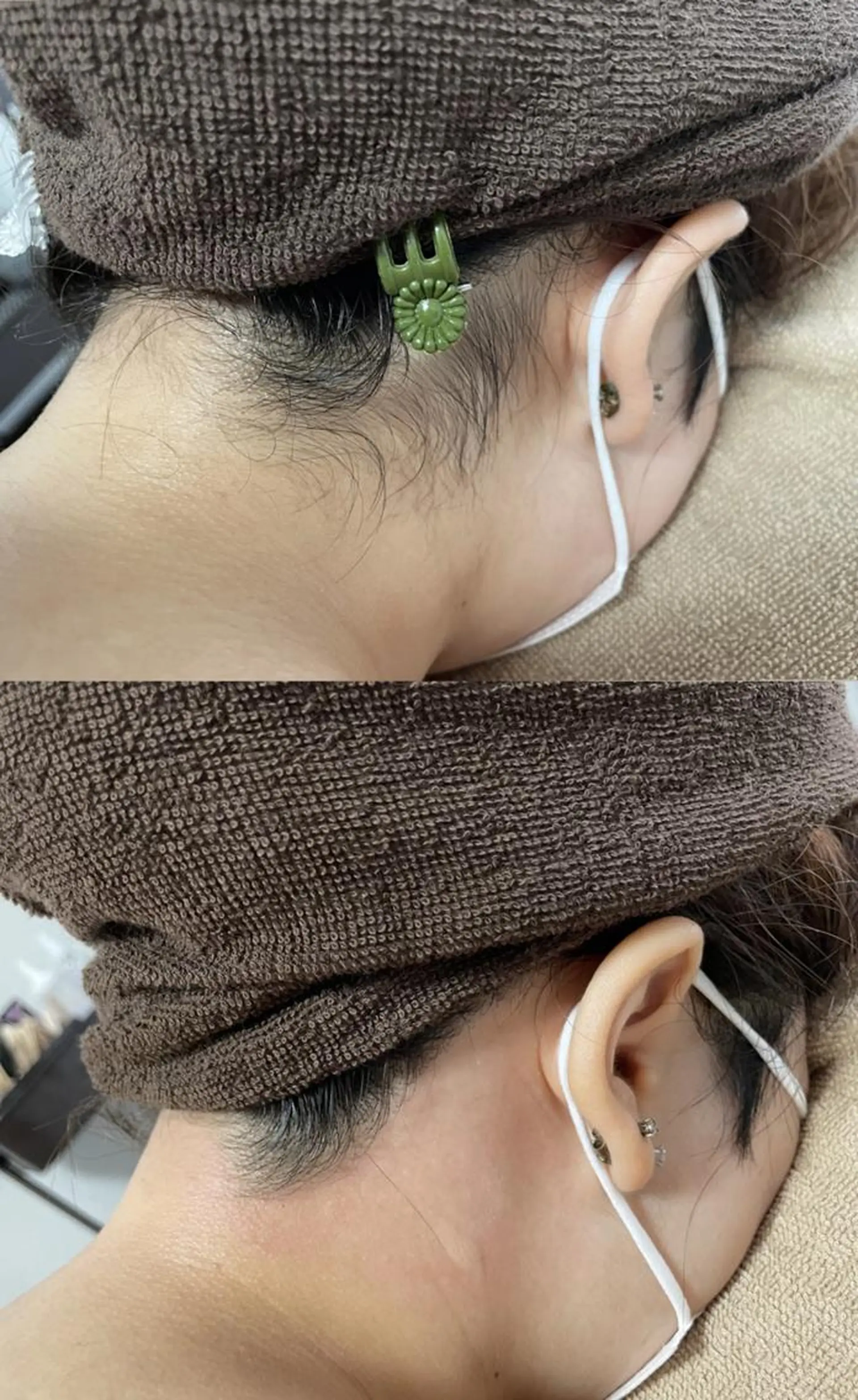 ショート メンズ 脱毛 Epina 千葉店 【エピナ】のエステ・リラクイメージ