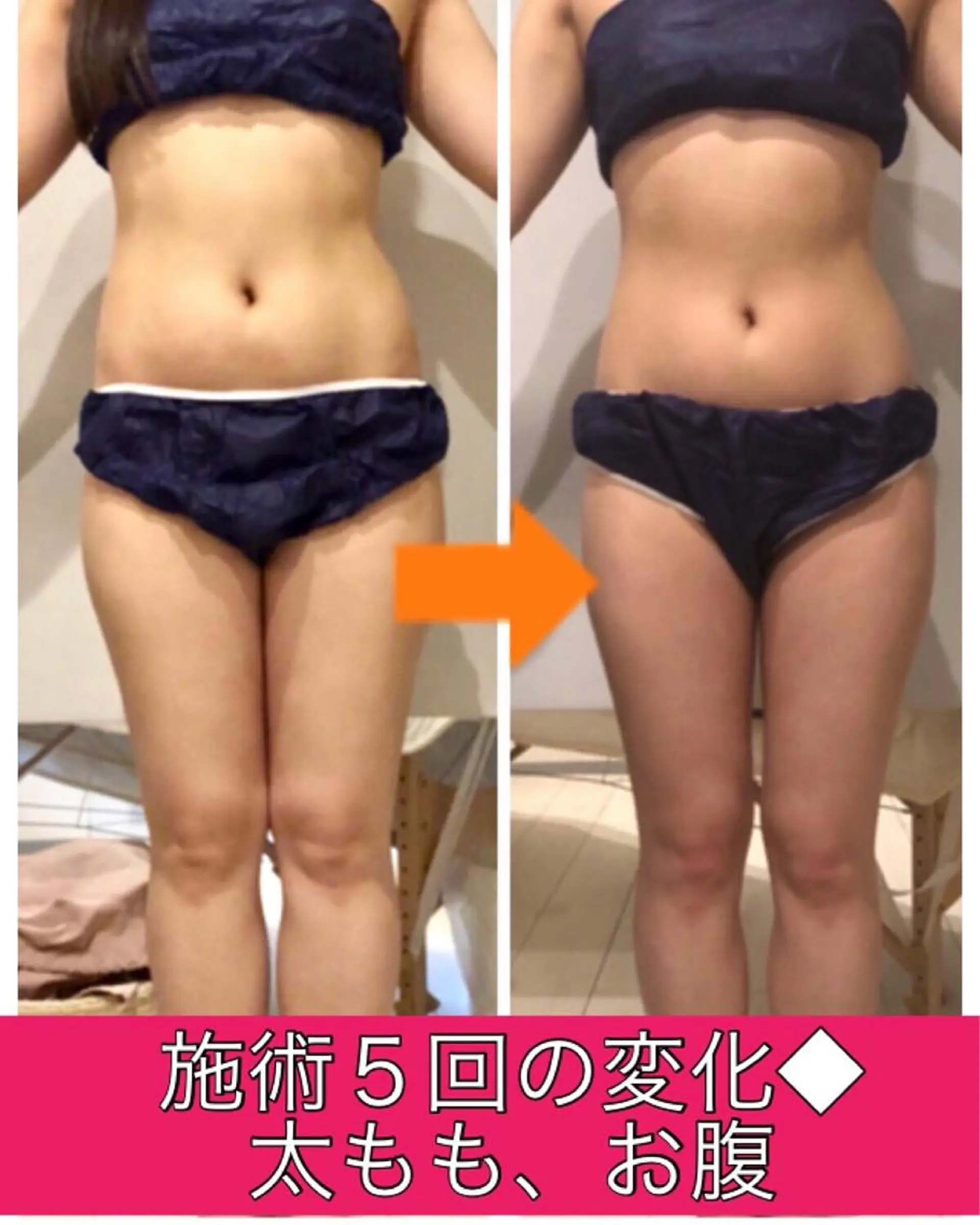 ロング カラー パーマ ヘアアレンジ メンズ キッズ ネイル マツエク・マツパ ‍痩身＆ボディ 結果出し🌟丹野のエステ・リラクイメージ