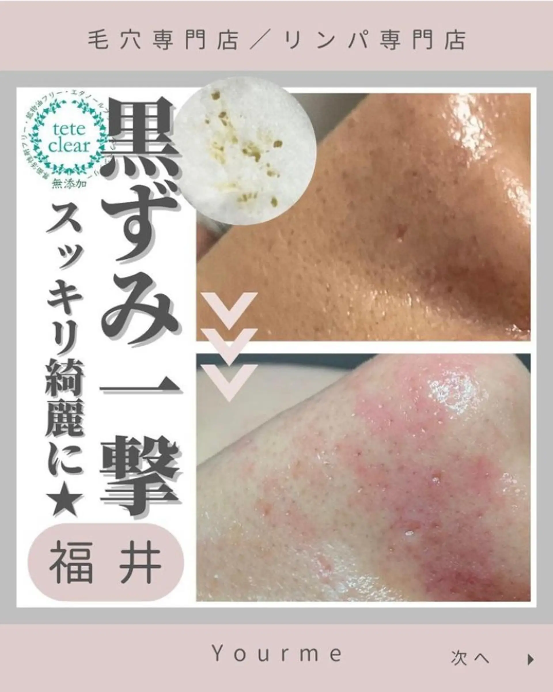 毛穴肌質ケアサロン Yourmeユアミーのエステ・リラクイメージ