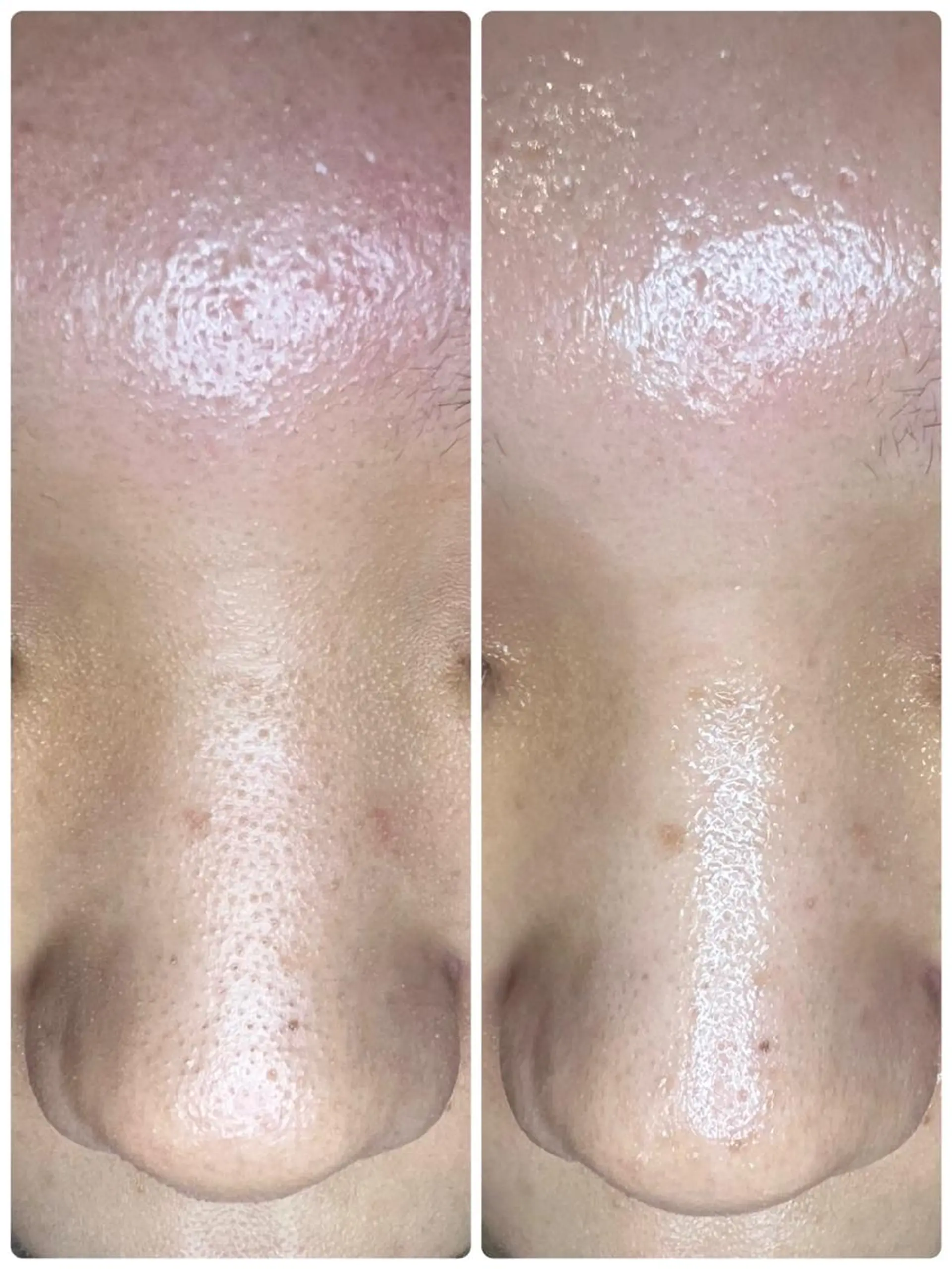 柳瀬 絵美のマツエク・マツパデザイン