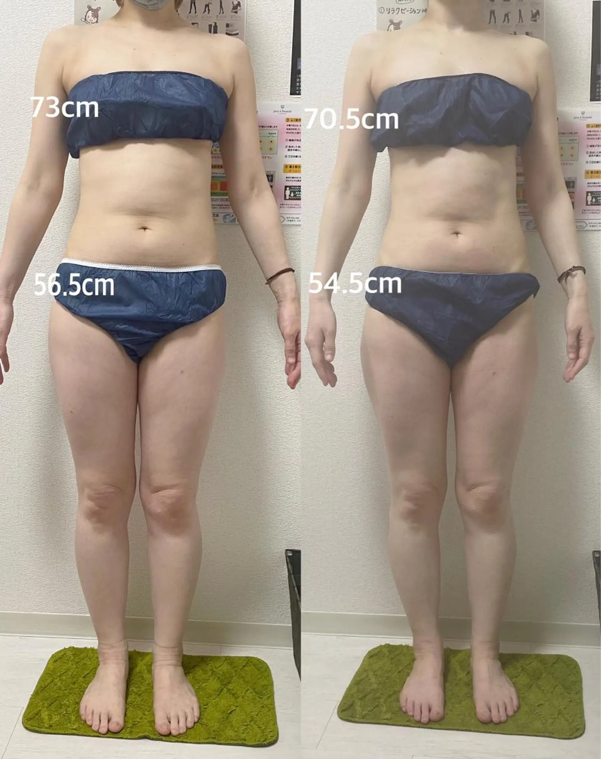 エステ 古山 由美子のその他イメージ