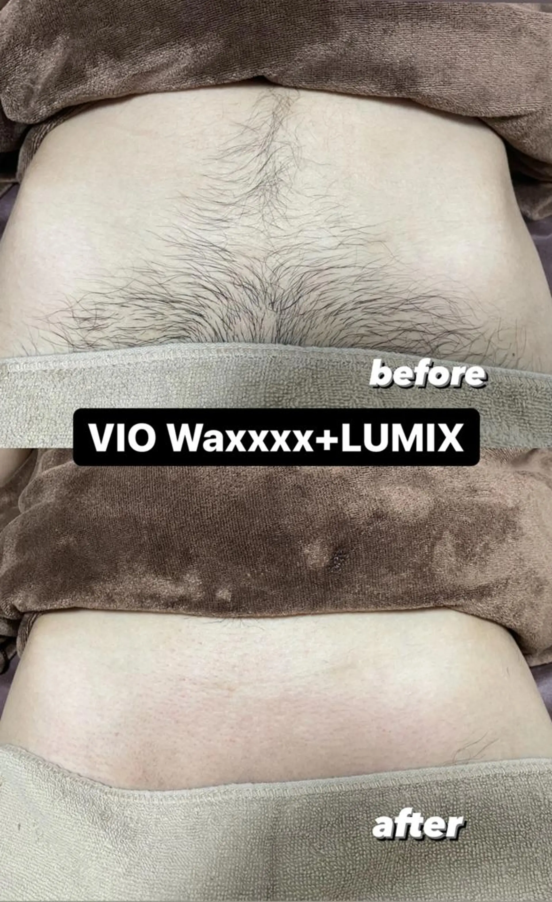 メンズ キッズ 脱毛 Epina 千葉店 【エピナ】のエステ・リラクイメージ