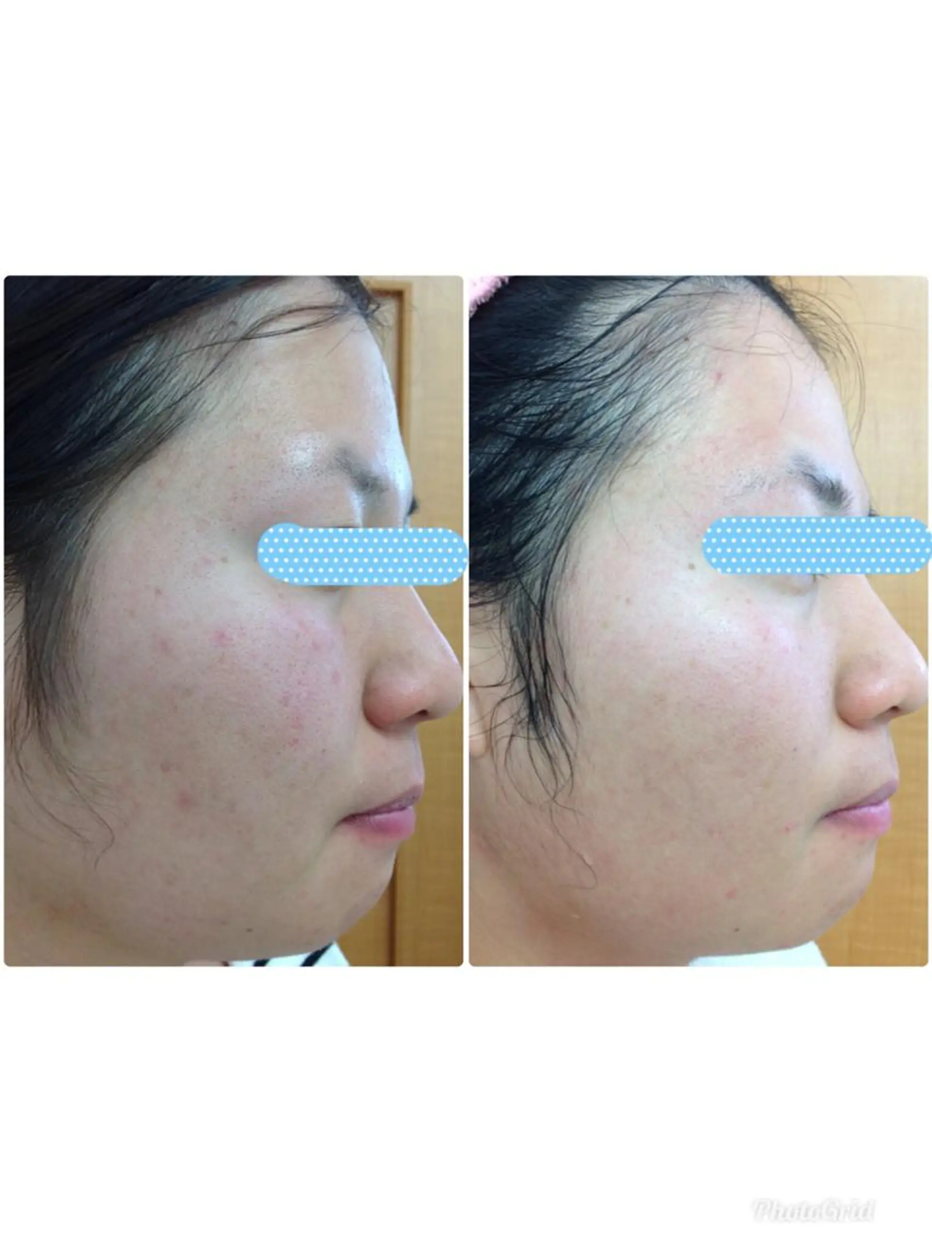 Facial stylist salon伊勢崎所属・中島 有希のエステ・リラクイメージ