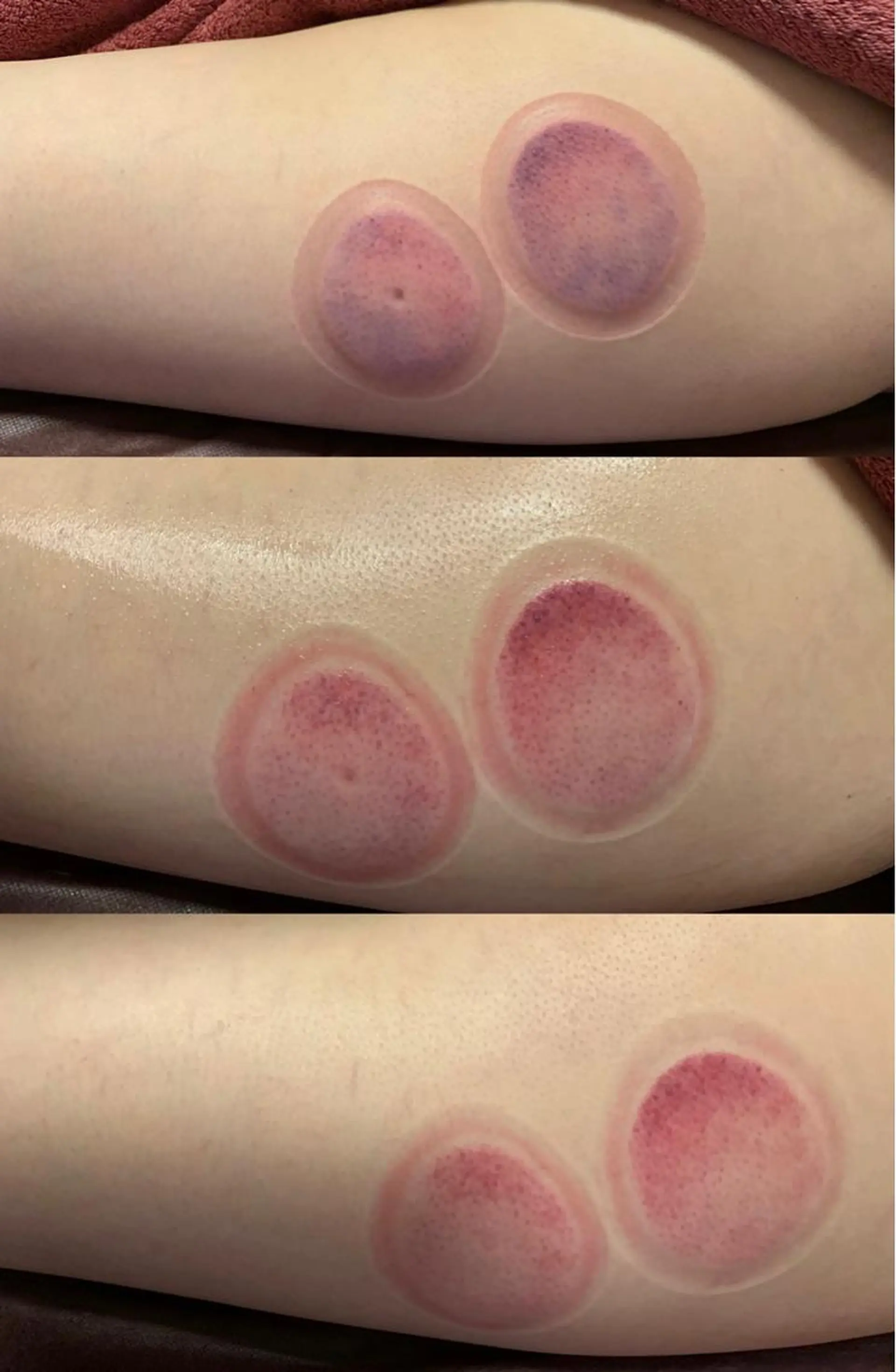 a  room salonのエステ・リラクイメージ