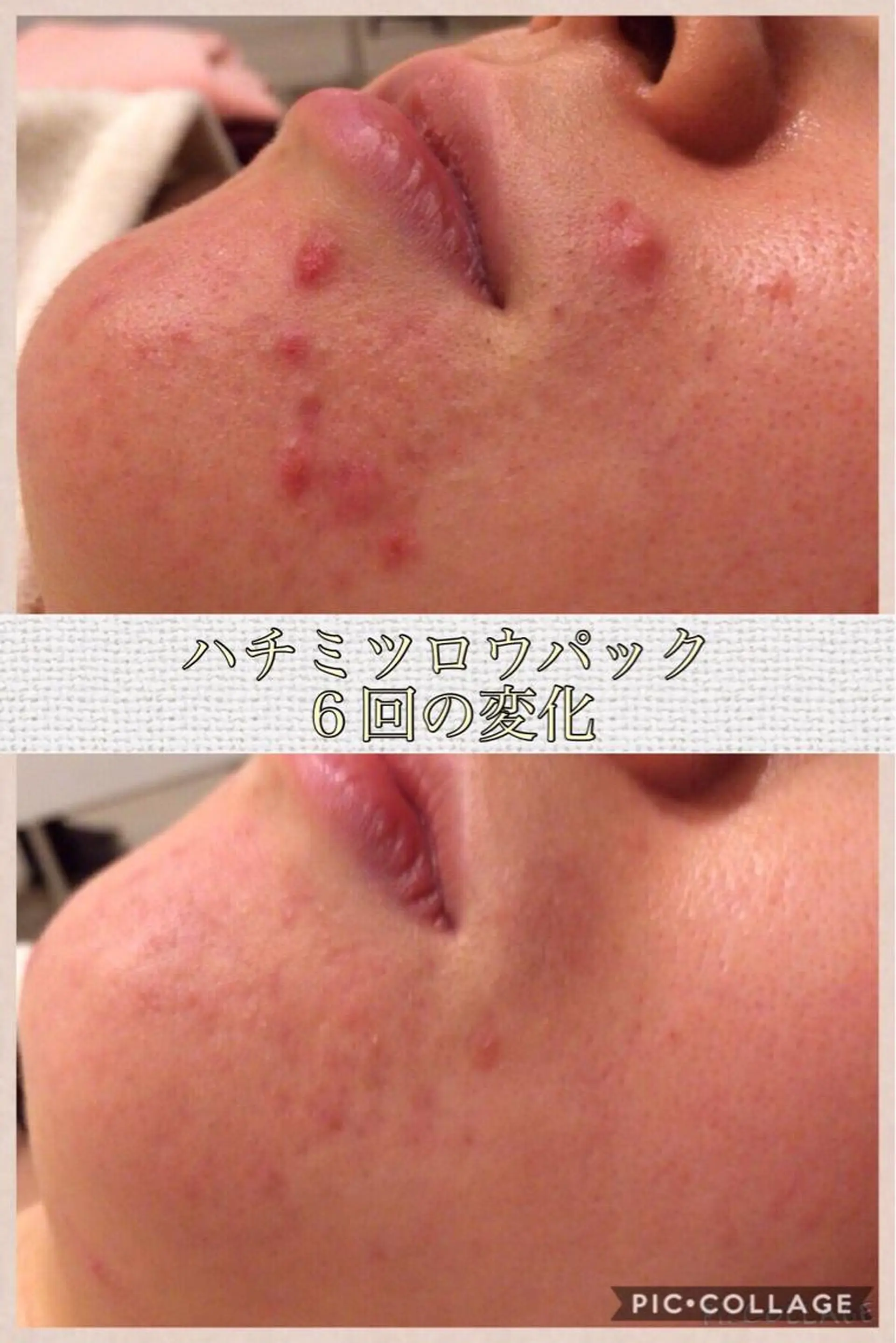 ニキビ・肌質改善専門 ♡人生が変わるサロンのエステ・リラクイメージ